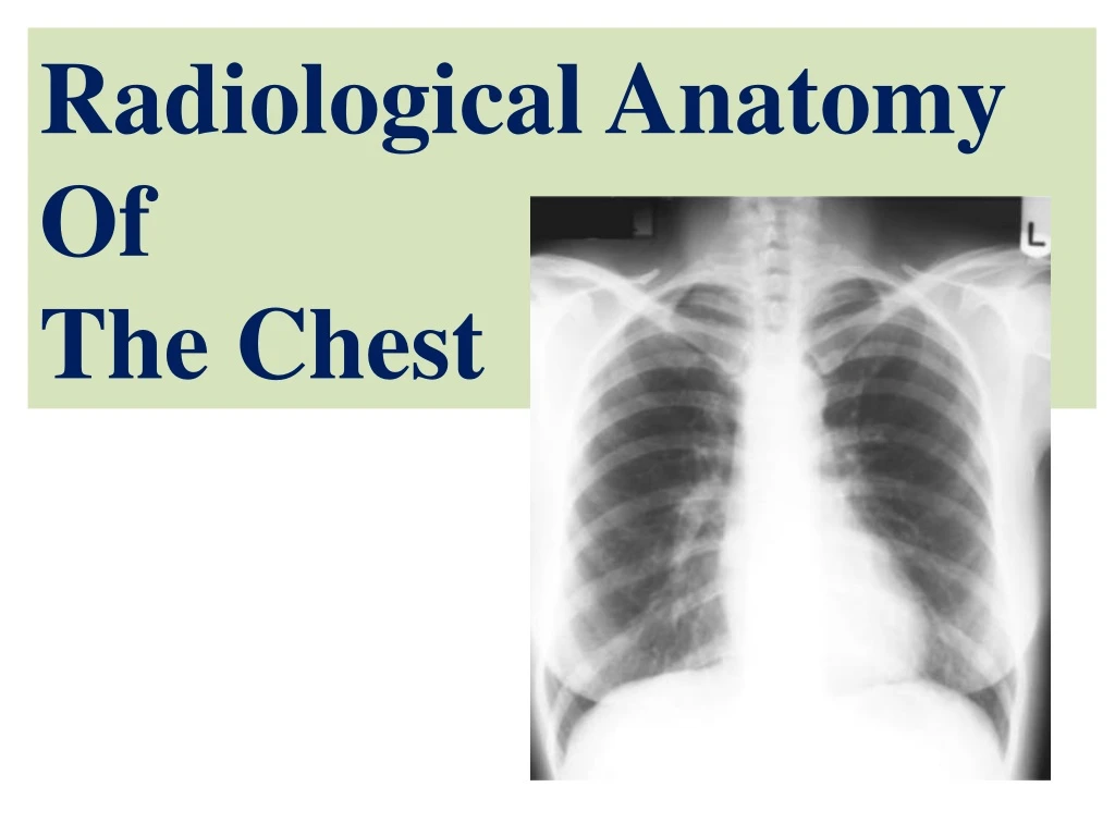 PPT - Radiological Anatomy Of The Chest PowerPoint Presentation, Free ...