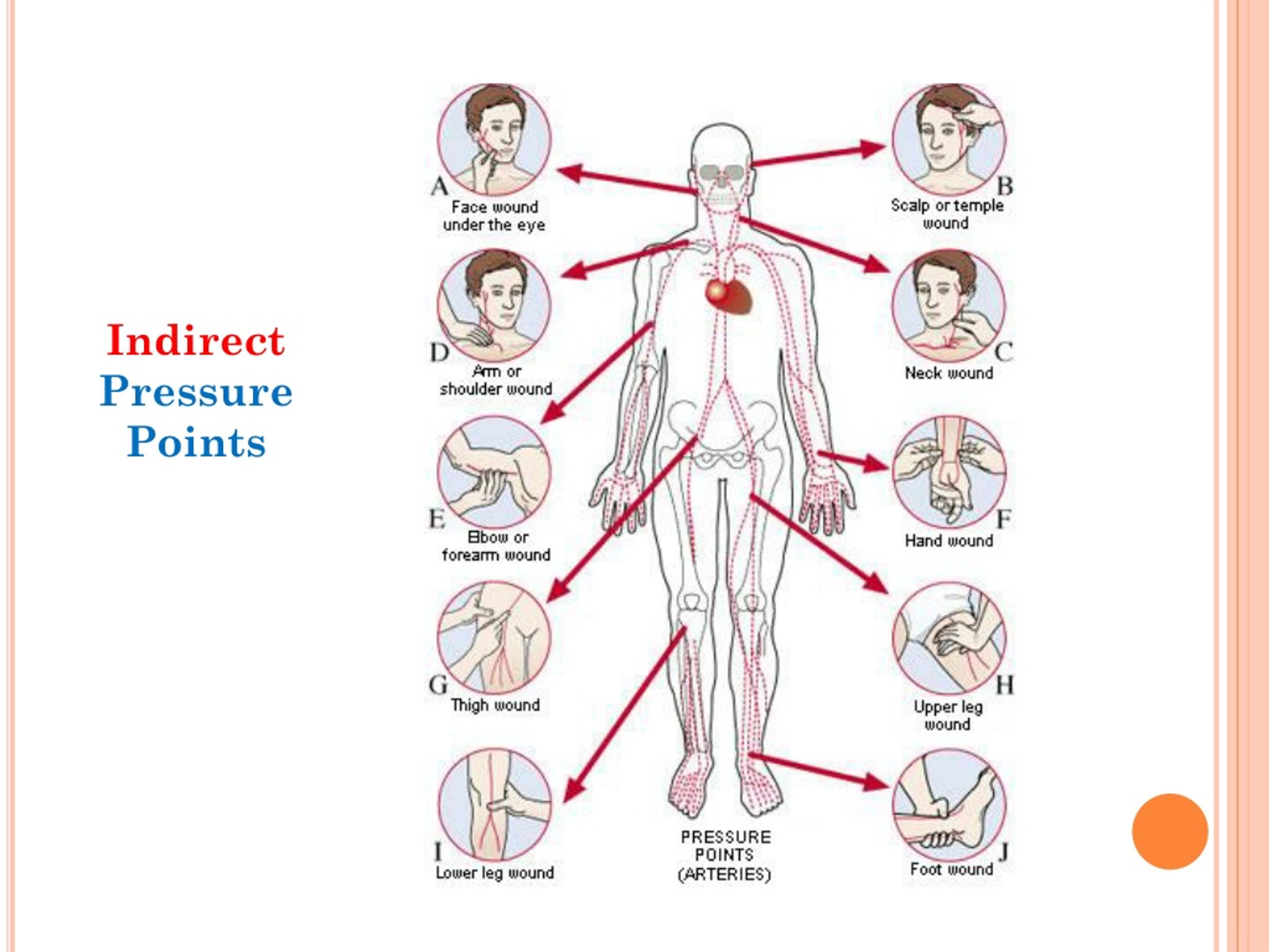 PPT - Bleeding PowerPoint Presentation, free download - ID:8885255