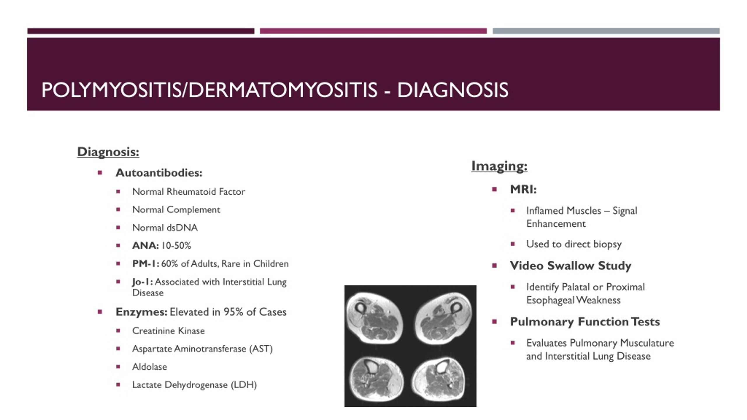 Ppt Dermatomyositis And Polymyositis Powerpoint Presentation Free