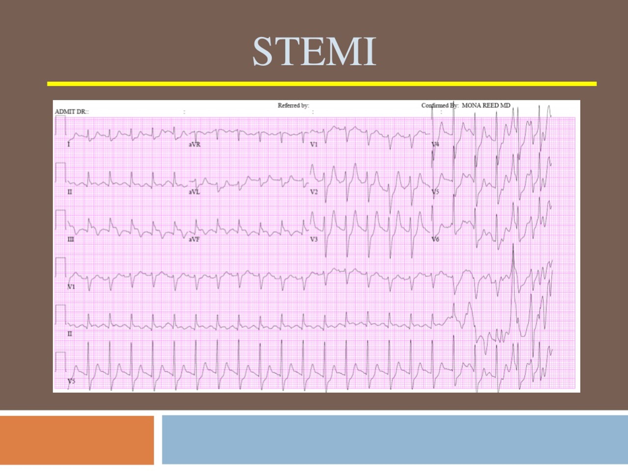 PPT - CHEST PAIN PowerPoint Presentation, Free Download - ID:8912424