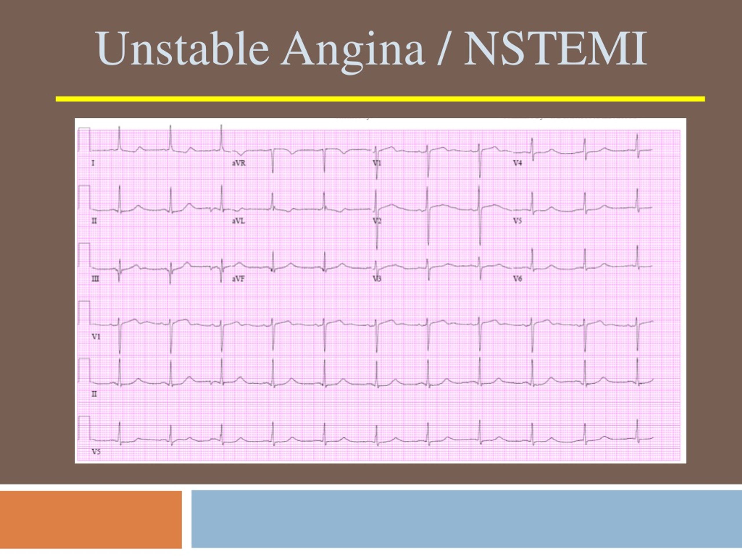 PPT - CHEST PAIN PowerPoint Presentation, Free Download - ID:8912424