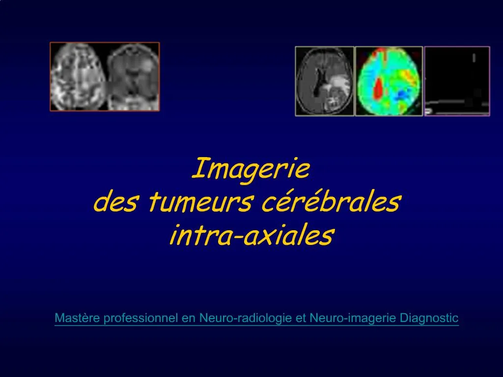 Ppt Imagerie Des Tumeurs C R Brales Intra Axiales Powerpoint Presentation Id