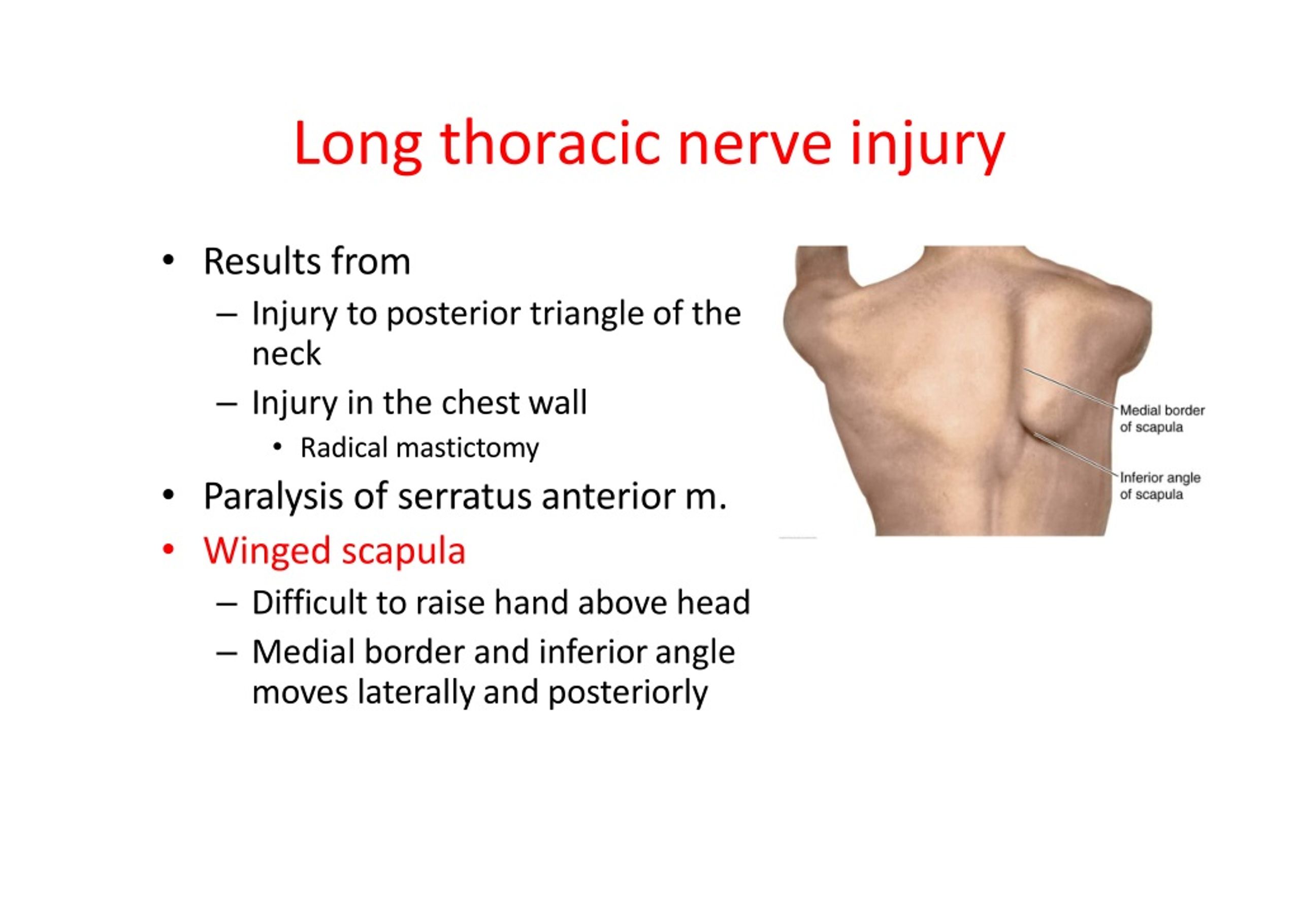 Ppt Upper Limb Nerves Powerpoint Presentation Free Download Id8918264 6592