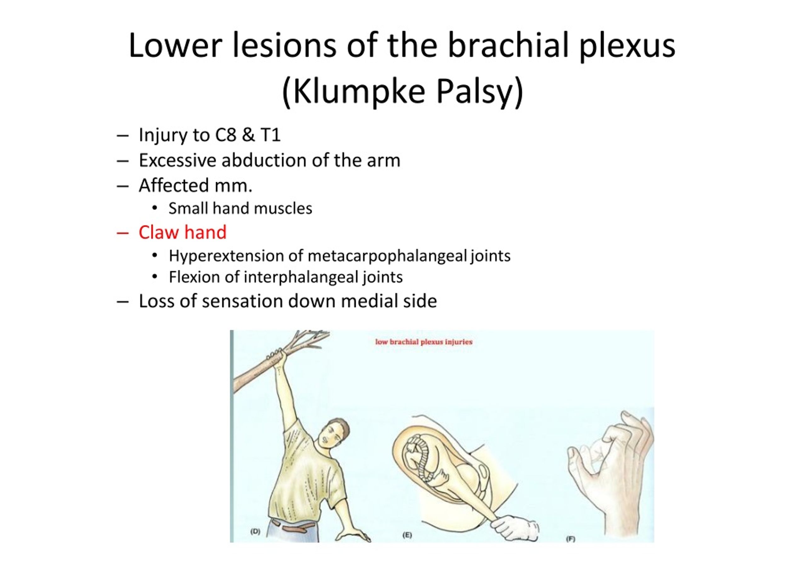 Ppt - Upper Limb: Nerves Powerpoint Presentation, Free Download - Id 