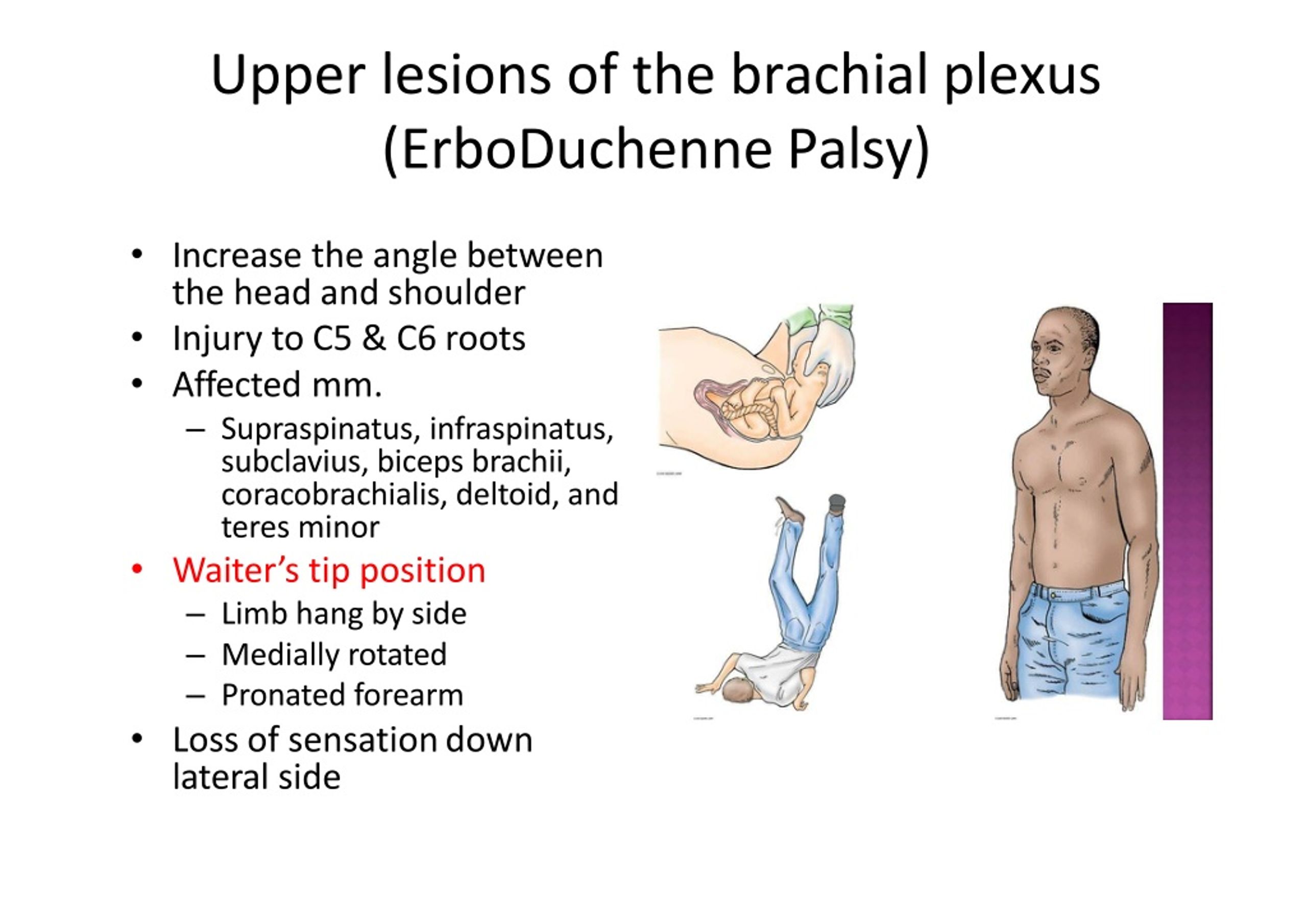 PPT - Upper Limb: Nerves PowerPoint Presentation, free download - ID ...