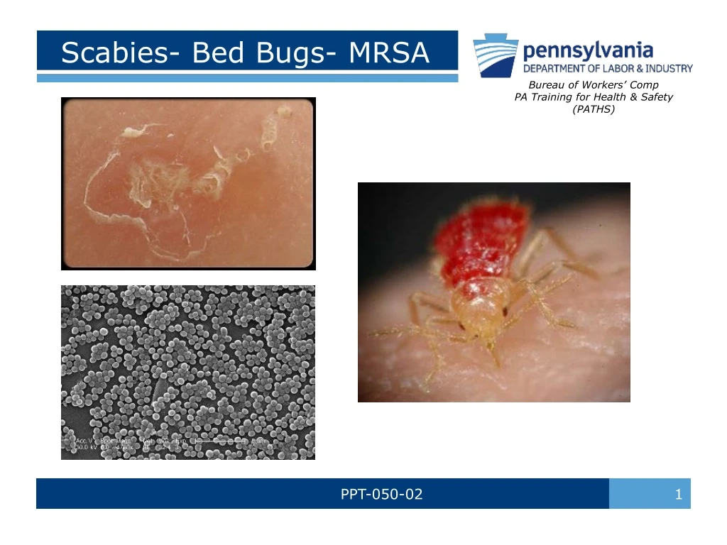 PPT Scabies Bed Bugs MRSA PowerPoint Presentation, free download