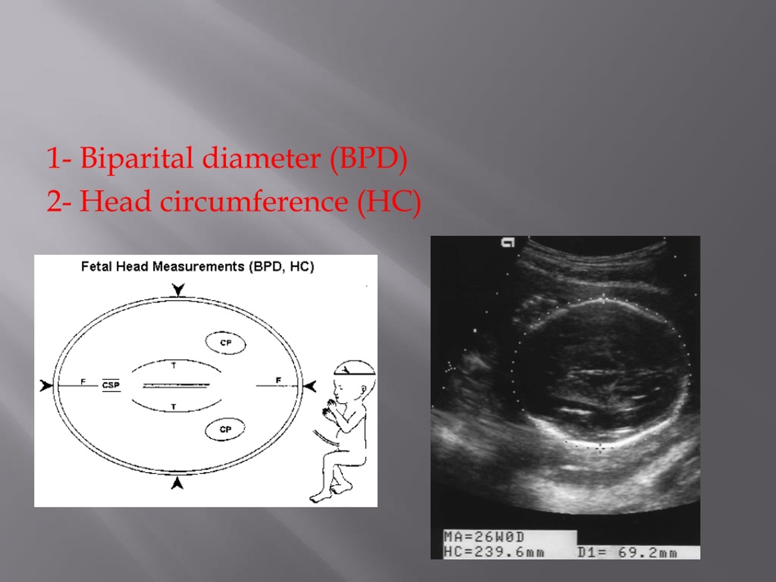 PPT - Obstetric Ultrasound PowerPoint Presentation, free download - ID ...