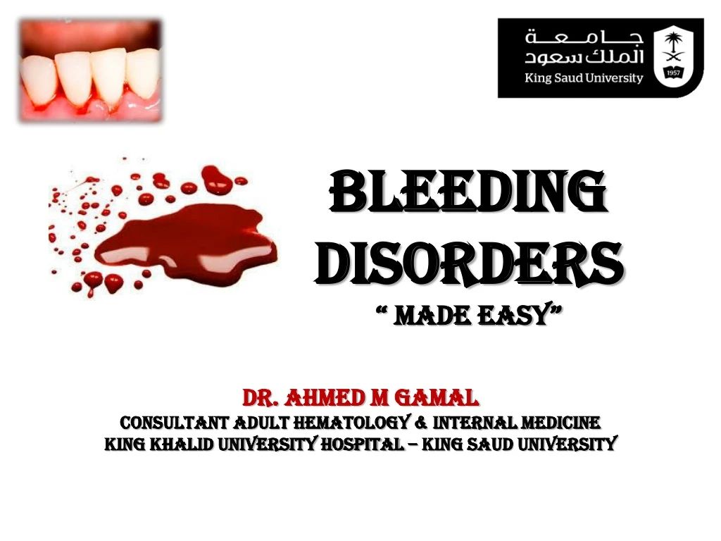 bleeding disorders made easy n.