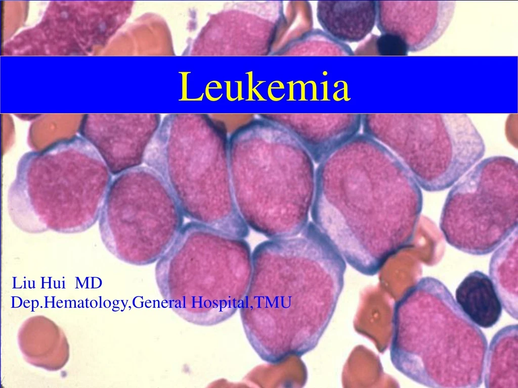 PPT Leukemia PowerPoint Presentation Free Download ID 8959458