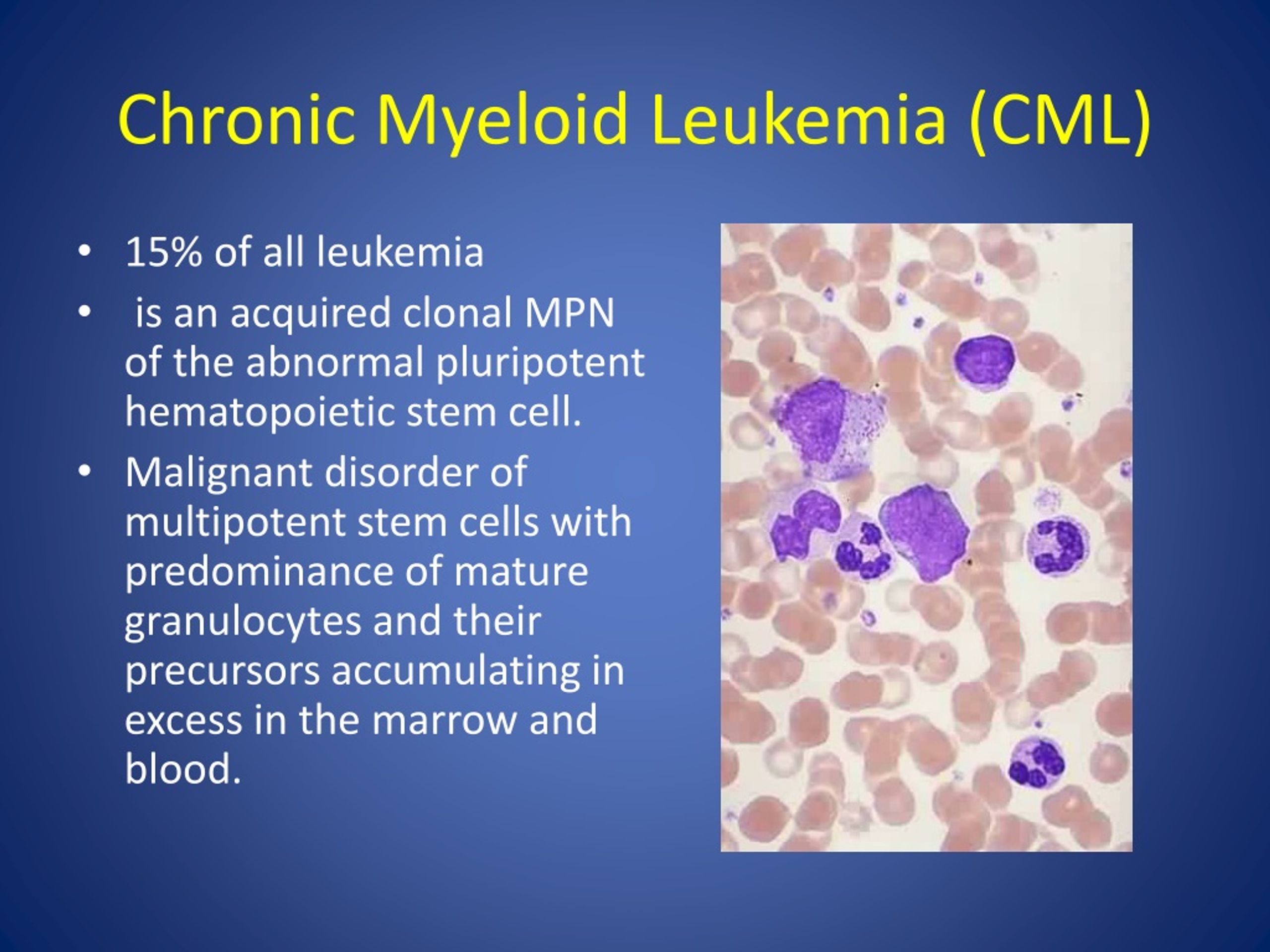 presentation of leukemia
