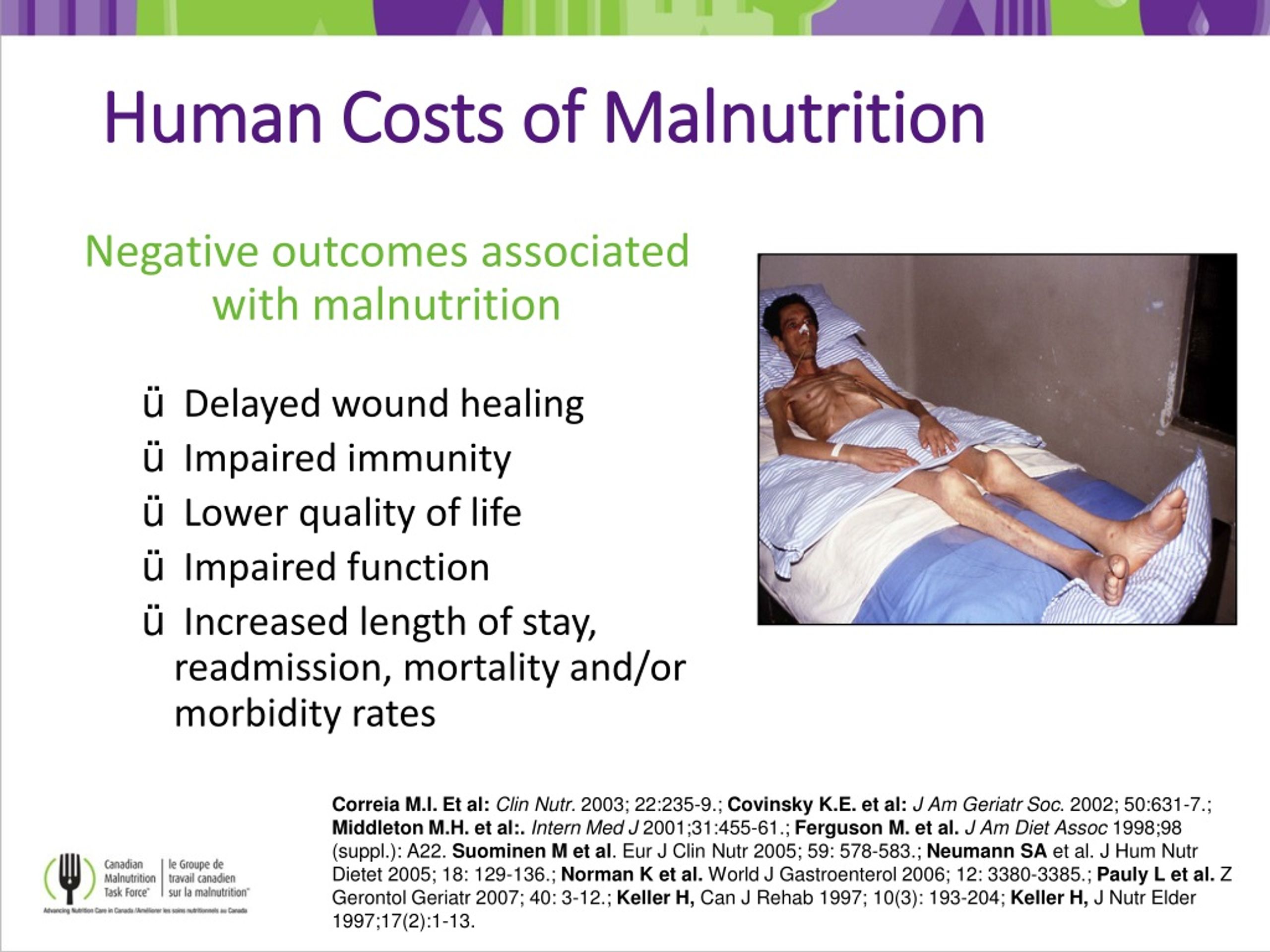 PPT - Malnutrition: Definition, Prevalence, Outcomes, And Cost ...