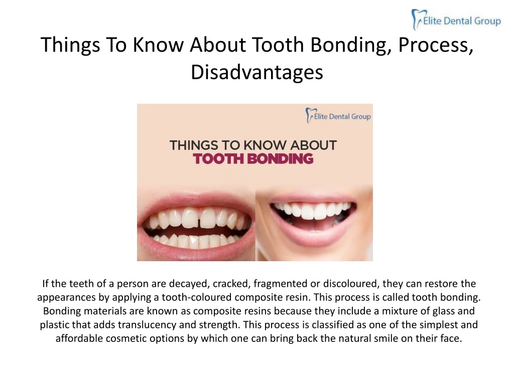 things to know about tooth bonding process disadvantages n.