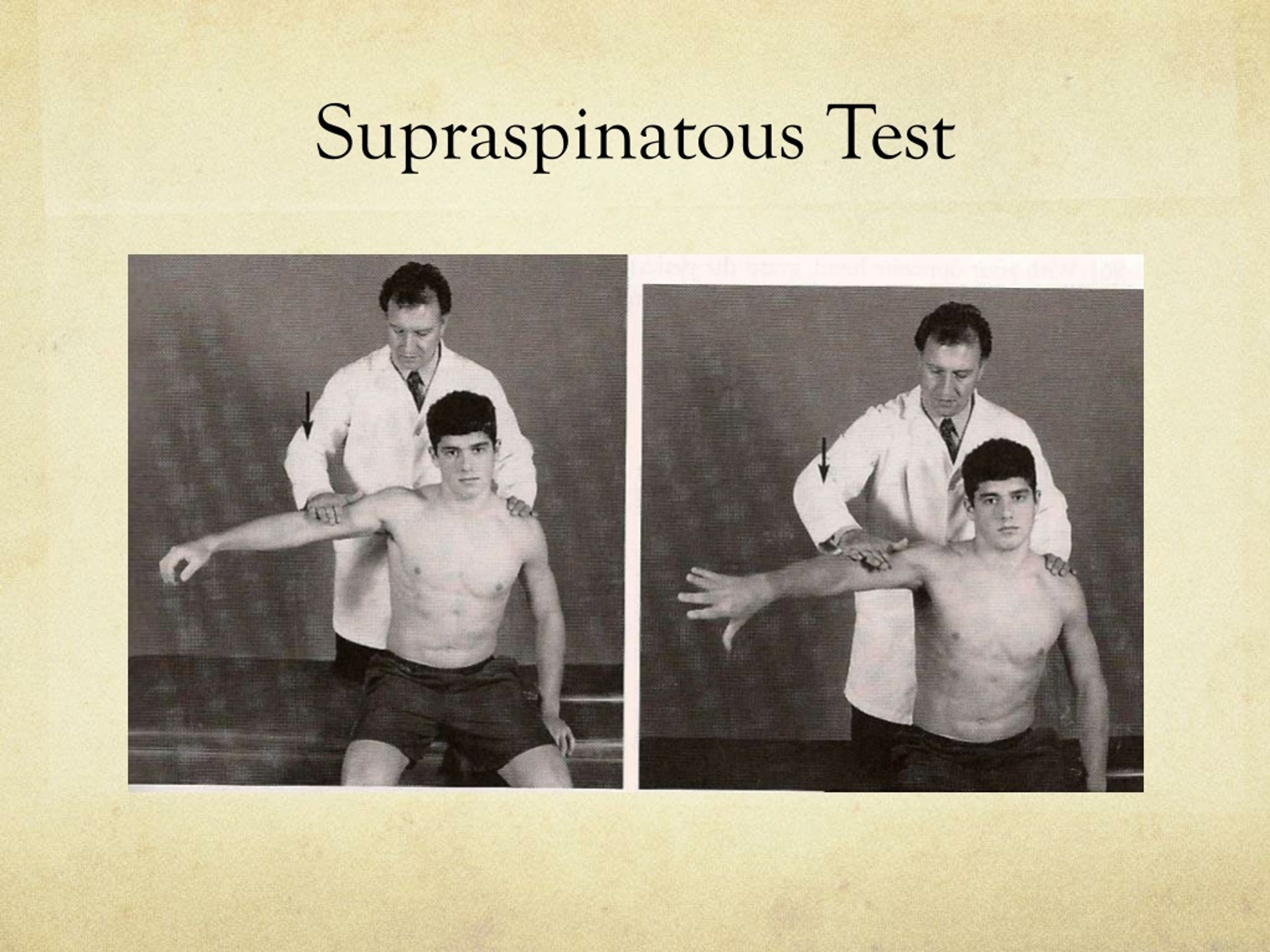 PPT Shoulder Tendinitis Tests Symptoms PowerPoint Presentation 