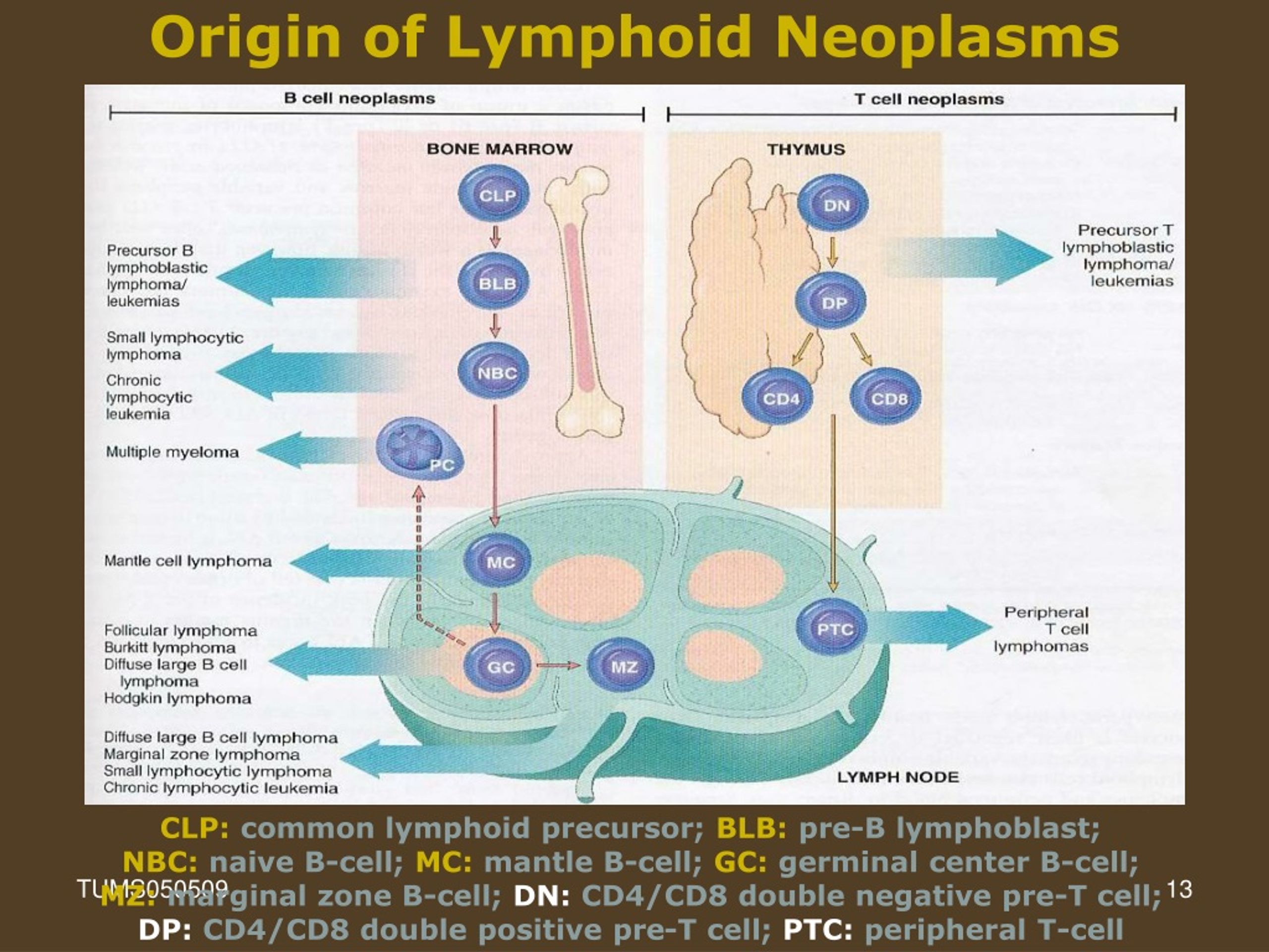 Ppt Lymphoid Neoplasm Powerpoint Presentation Free Download Id9074365 