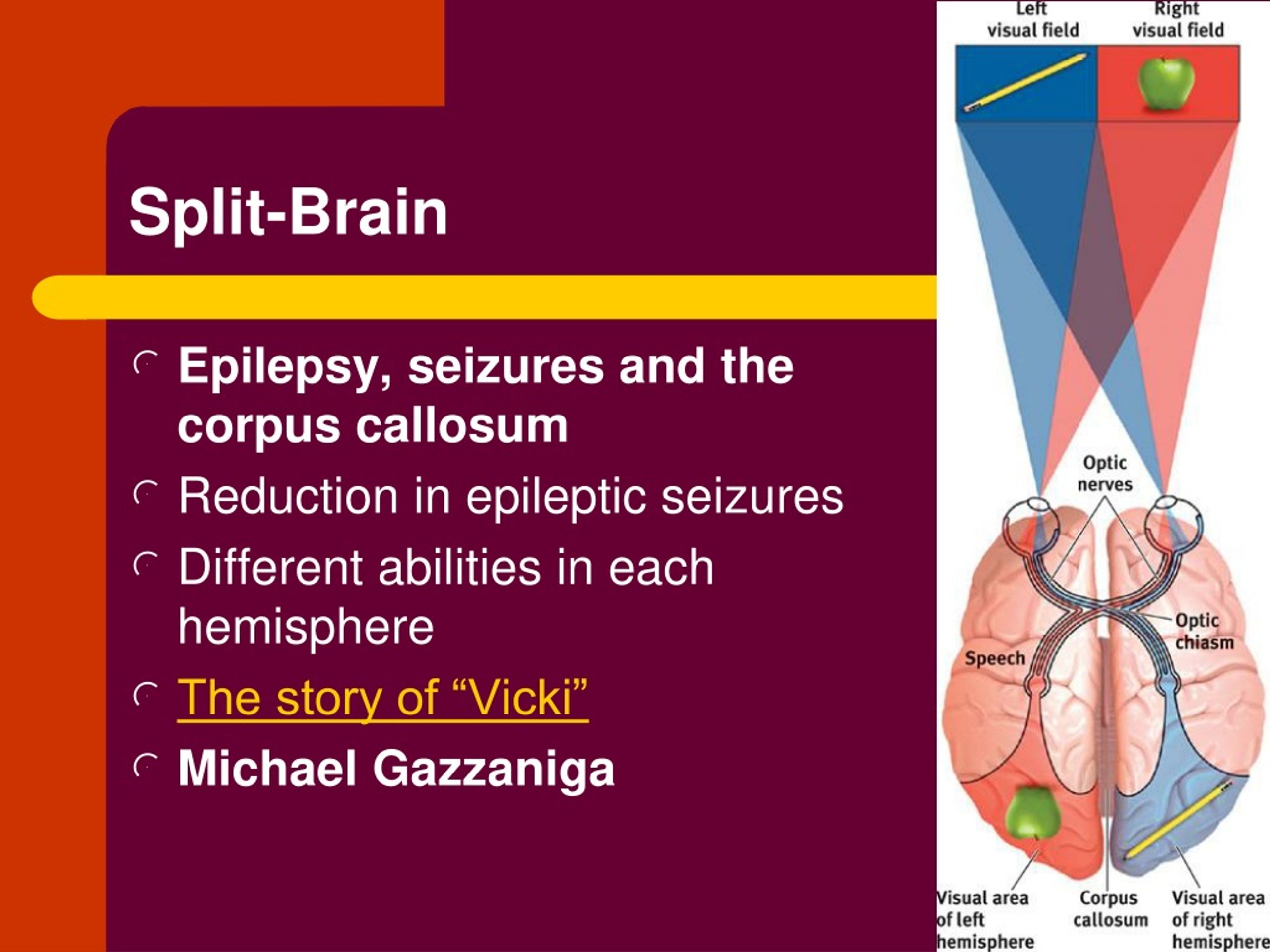Split brain. Корпусная каллозотомия. The prevalence of Epilepsy.