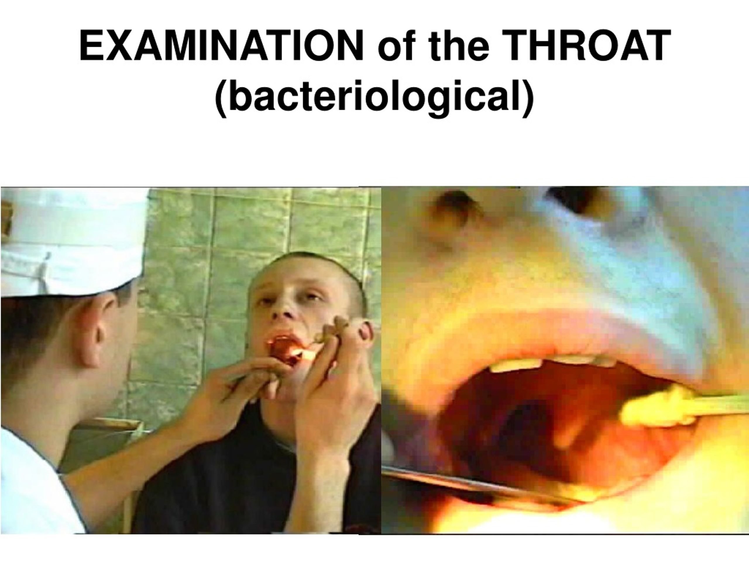 PPT - Sore Throat Anatomy, phisiology, examination and illnesses of the ...