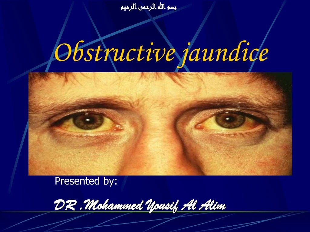 powerpoint presentation of obstructive jaundice