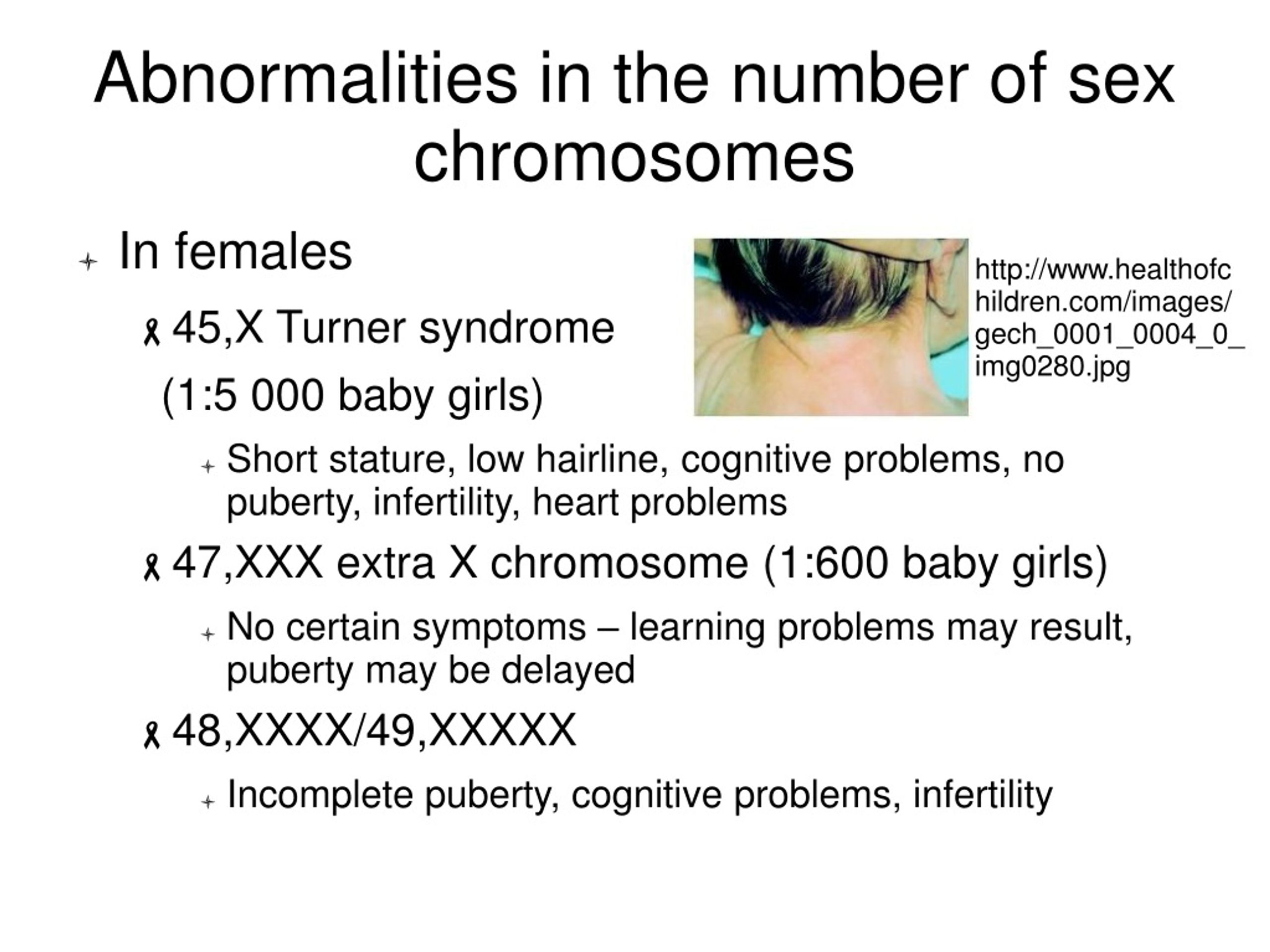Ppt Chromosome Disorders Numerical Abnormalities Powerpoint Presentation Id