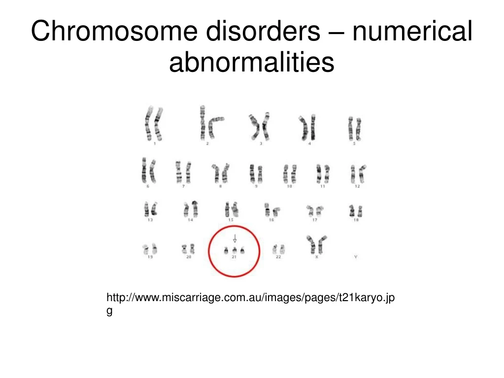 ppt-chromosome-disorders-numerical-abnormalities-powerpoint