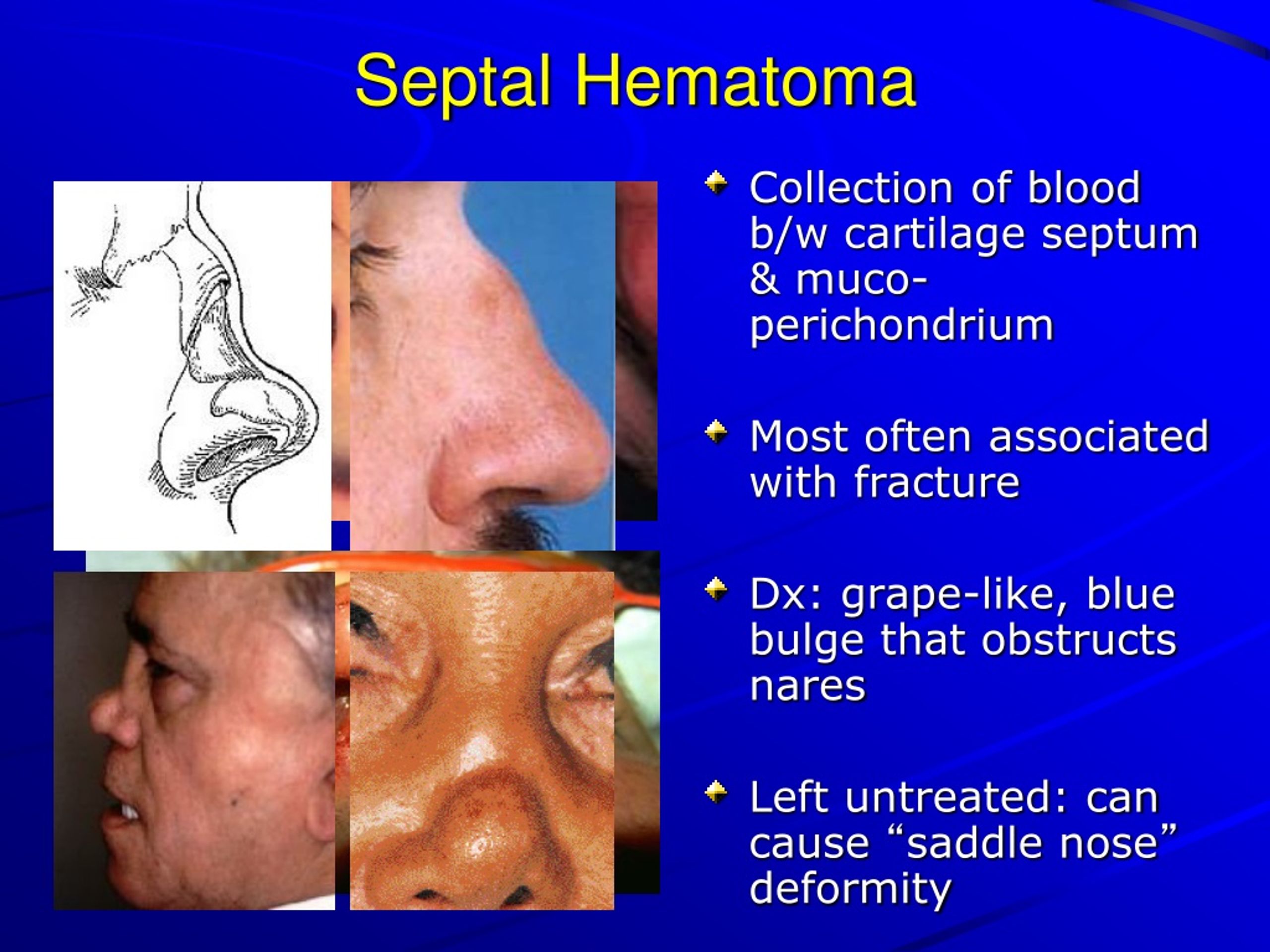PPT Facial Injuries In Sports And Exercise PowerPoint Presentation PPT Facial Injuries In Sports And Exercise PowerPoint Presentation