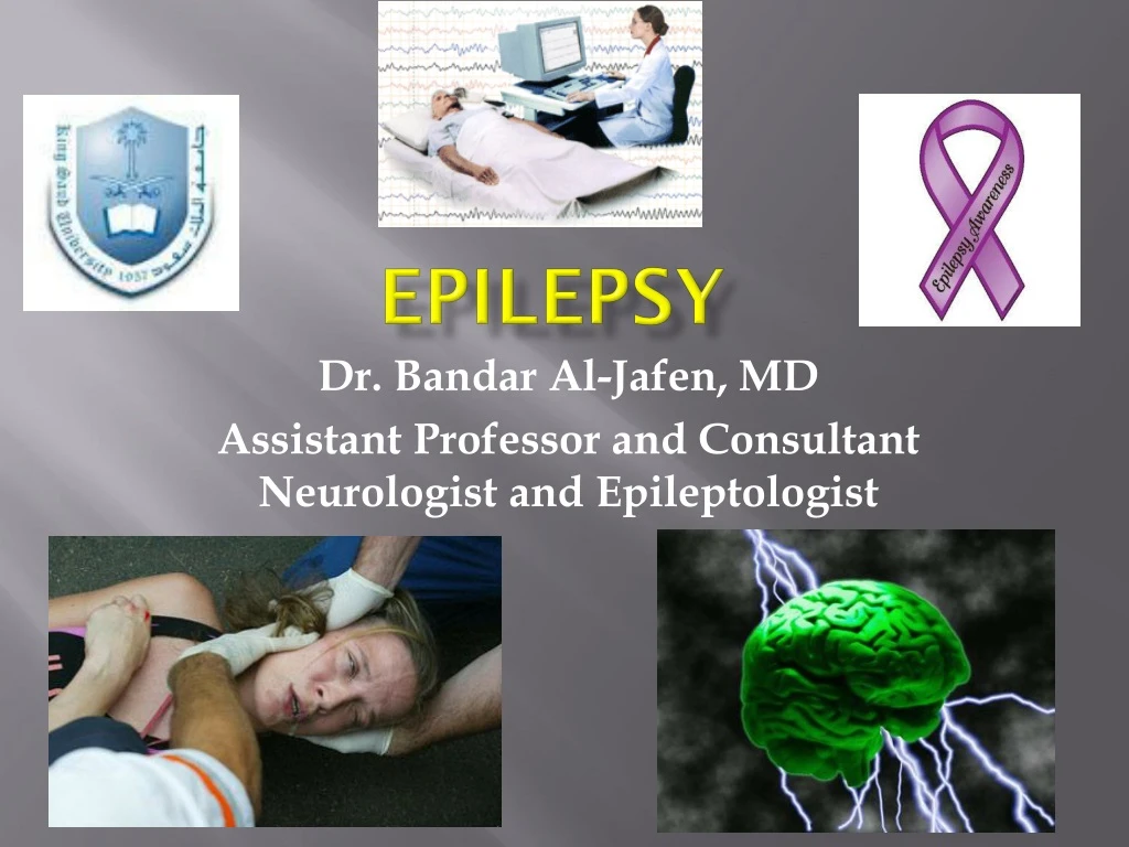 PPT - Epilepsy PowerPoint Presentation, free download - ID:9113495
