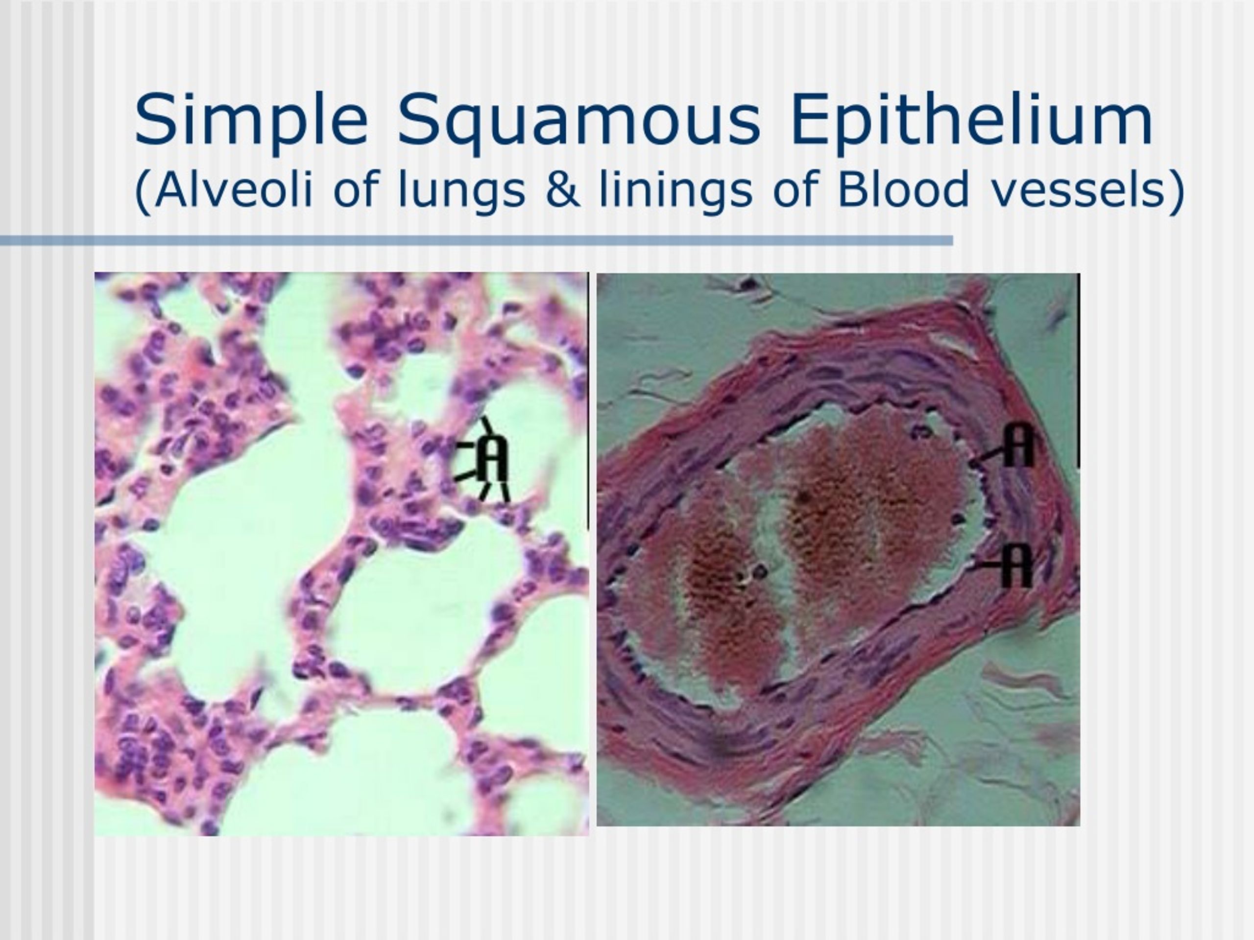 Simple Squamous Epithelium Lung Alveoli