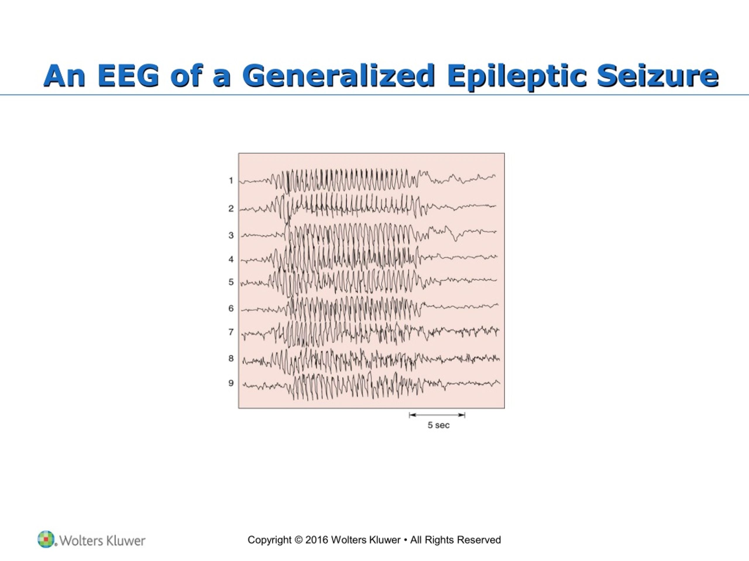 PPT - Chapter 19: Brain Rhythms and Sleep PowerPoint Presentation, free ...