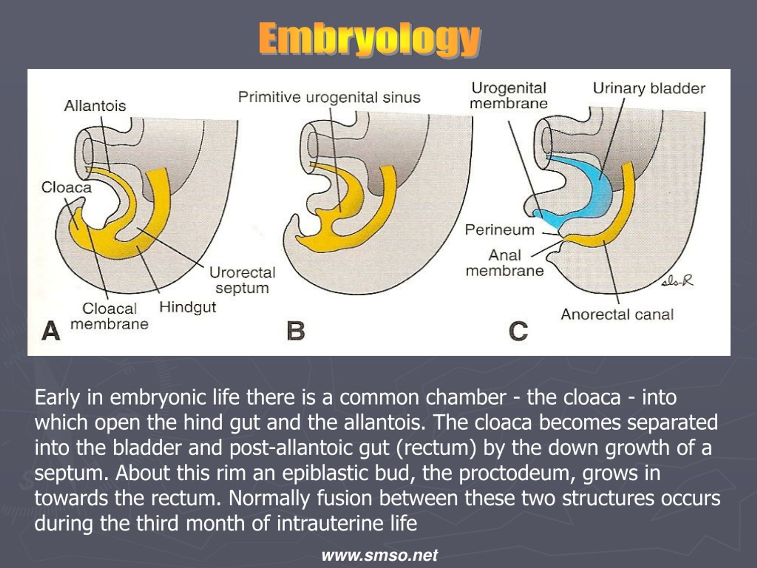 case study on anorectal malformation slideshare