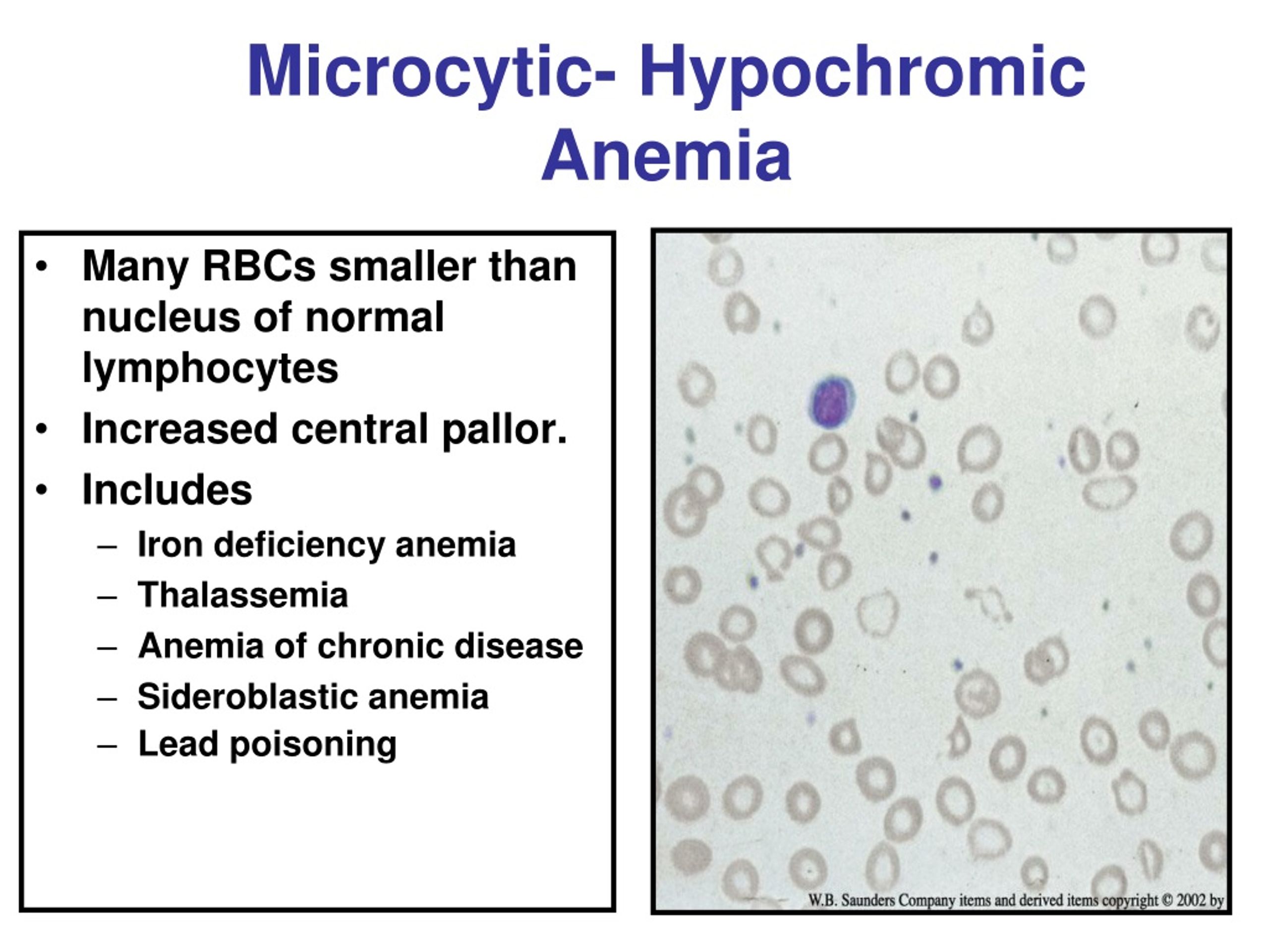 PPT Anemia And Laboratory Diagnosis Overview PowerPoint Presentation 