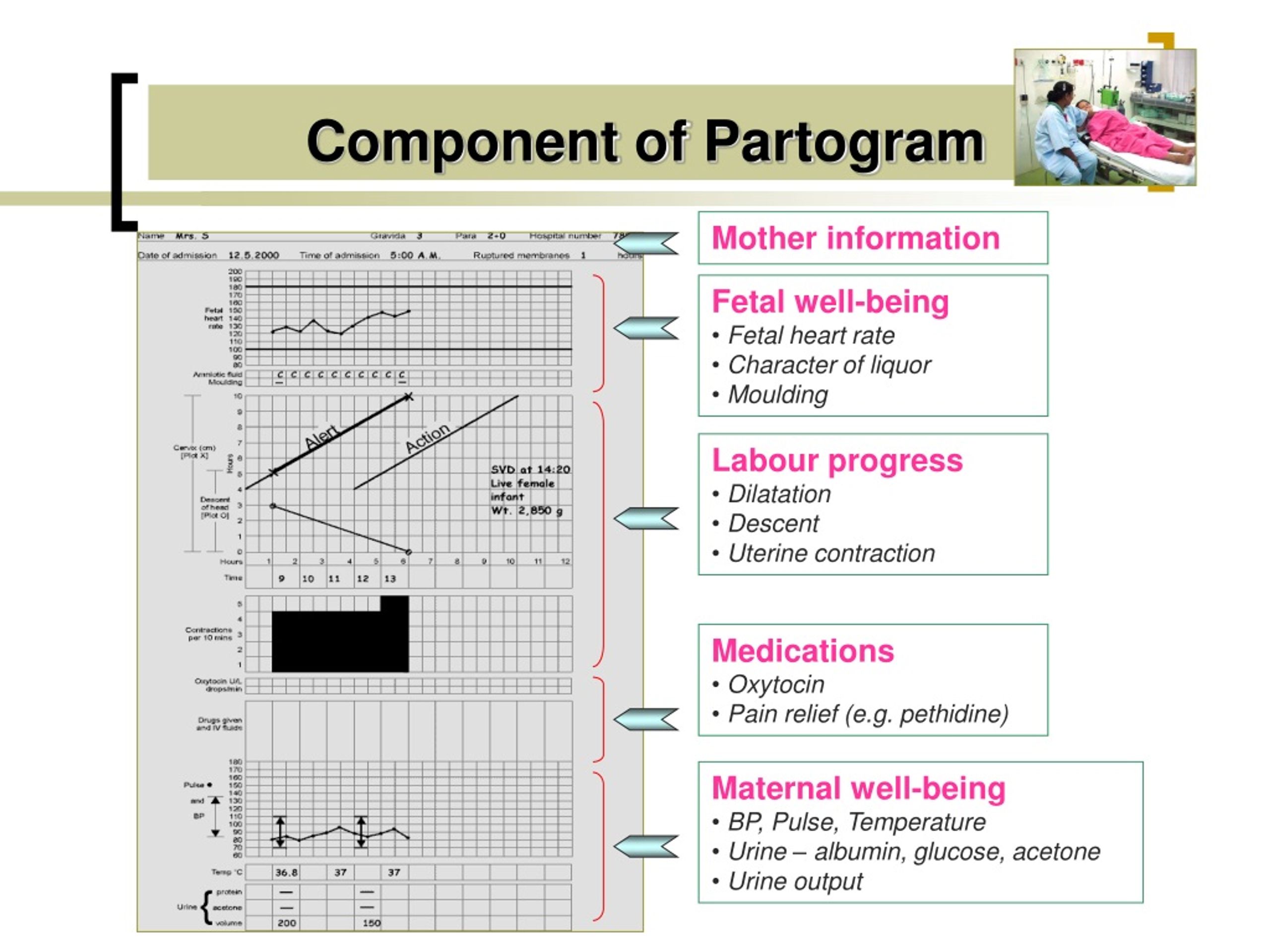 Ppt Partogram Powerpoint Presentation Free Download Id9165825