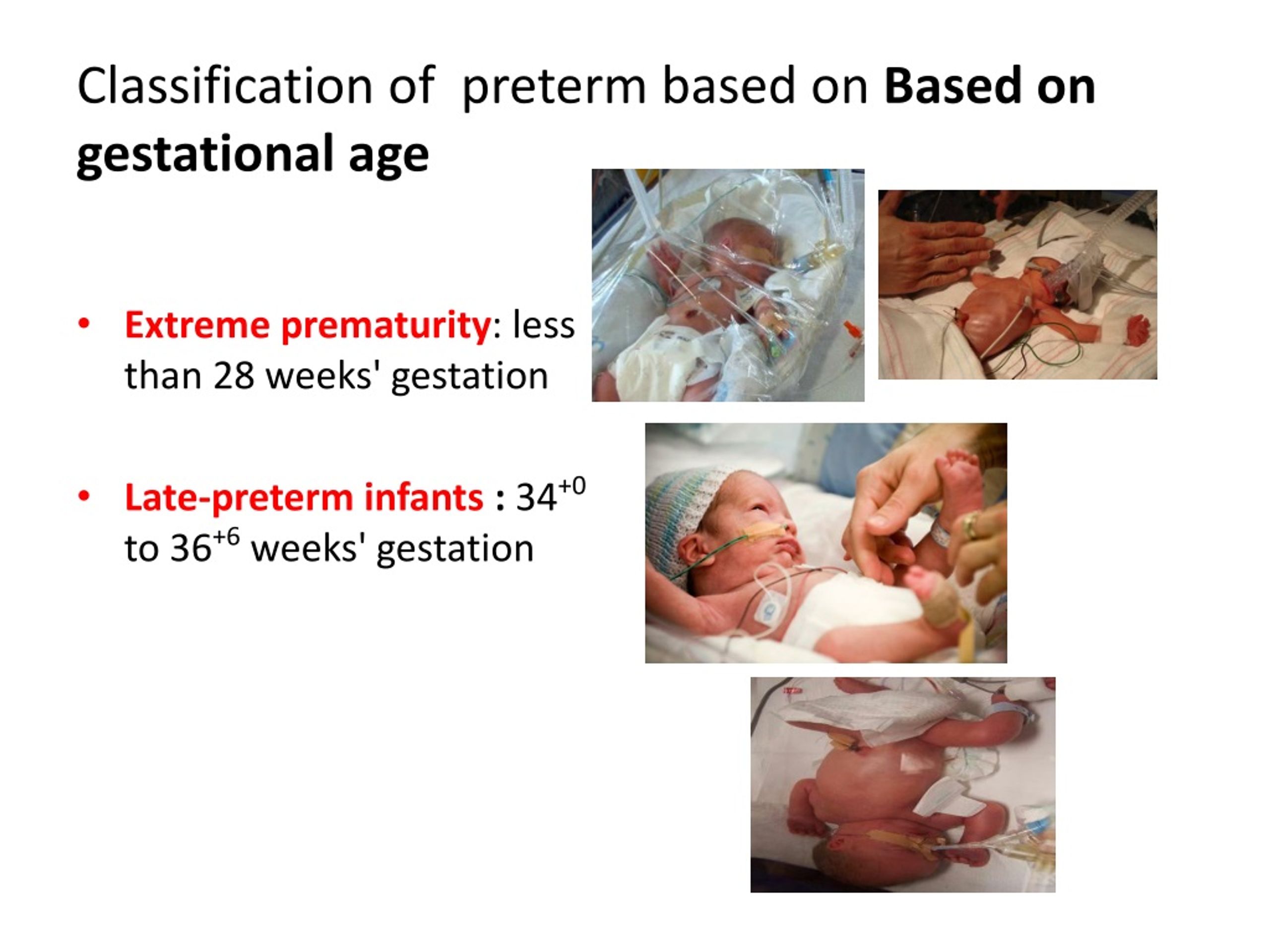 case study on preterm baby slideshare