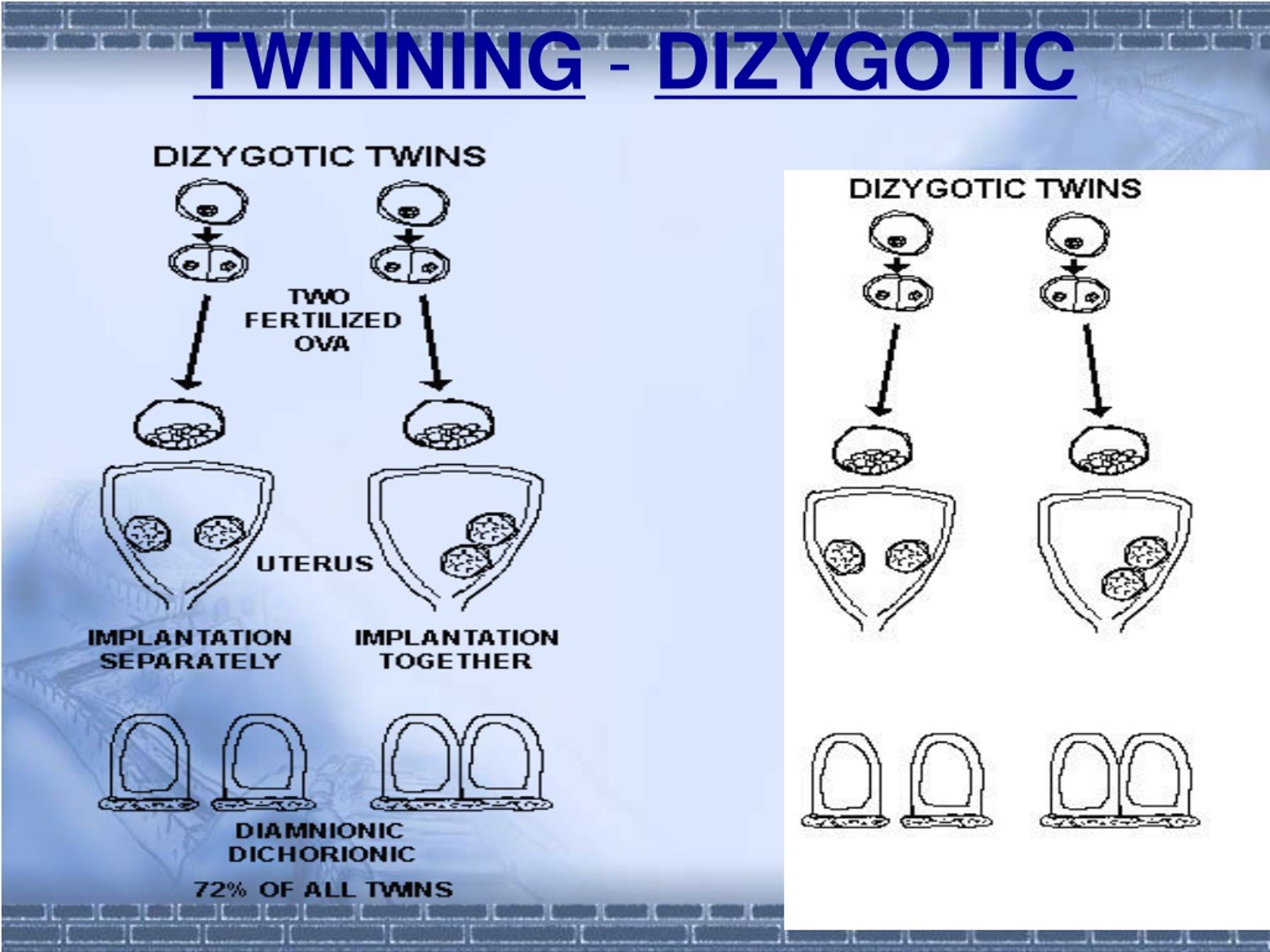 PPT - Twins And Multiple Birth 1.Twins Monozygotic Twins Dizygotic ...