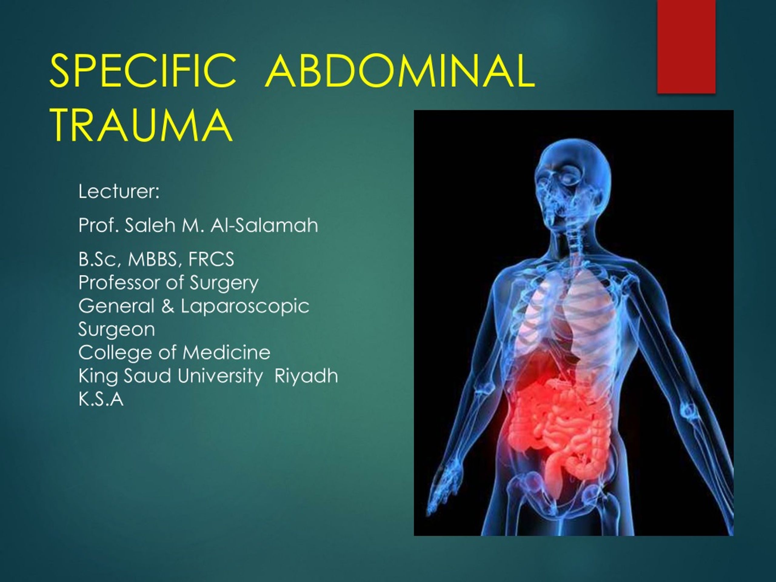 literature review trauma abdomen