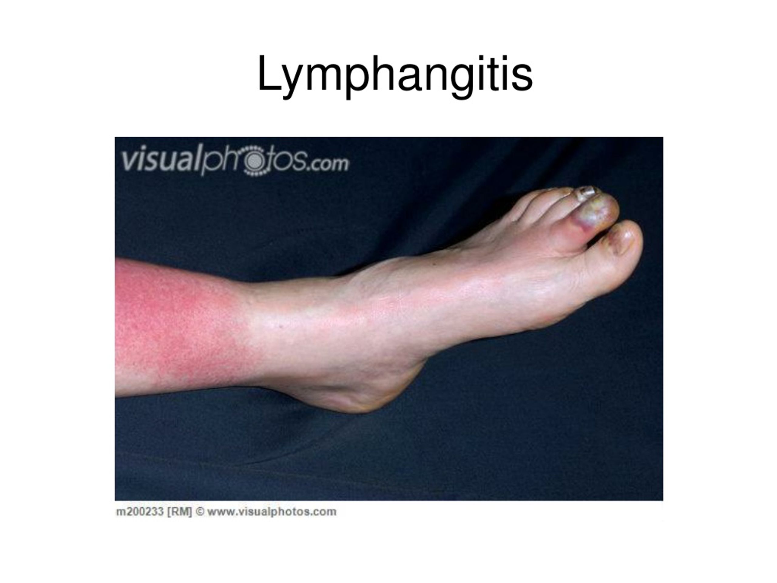 PPT Venous And Lymphatic Drainage Of Lower Limb PowerPoint 