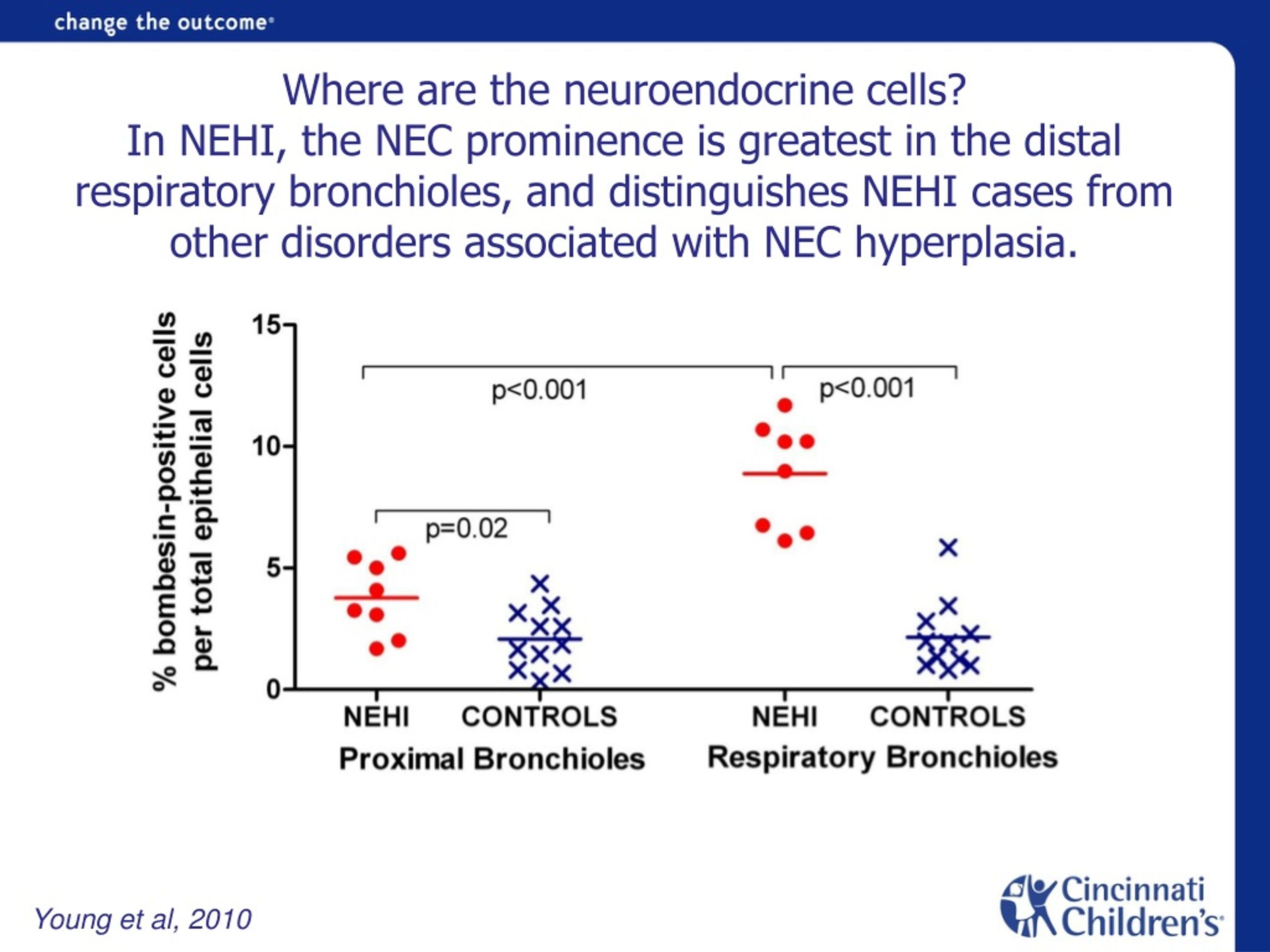 PPT - Neuroendocrine cell Hyperplasia of Infancy (NEHI) PowerPoint