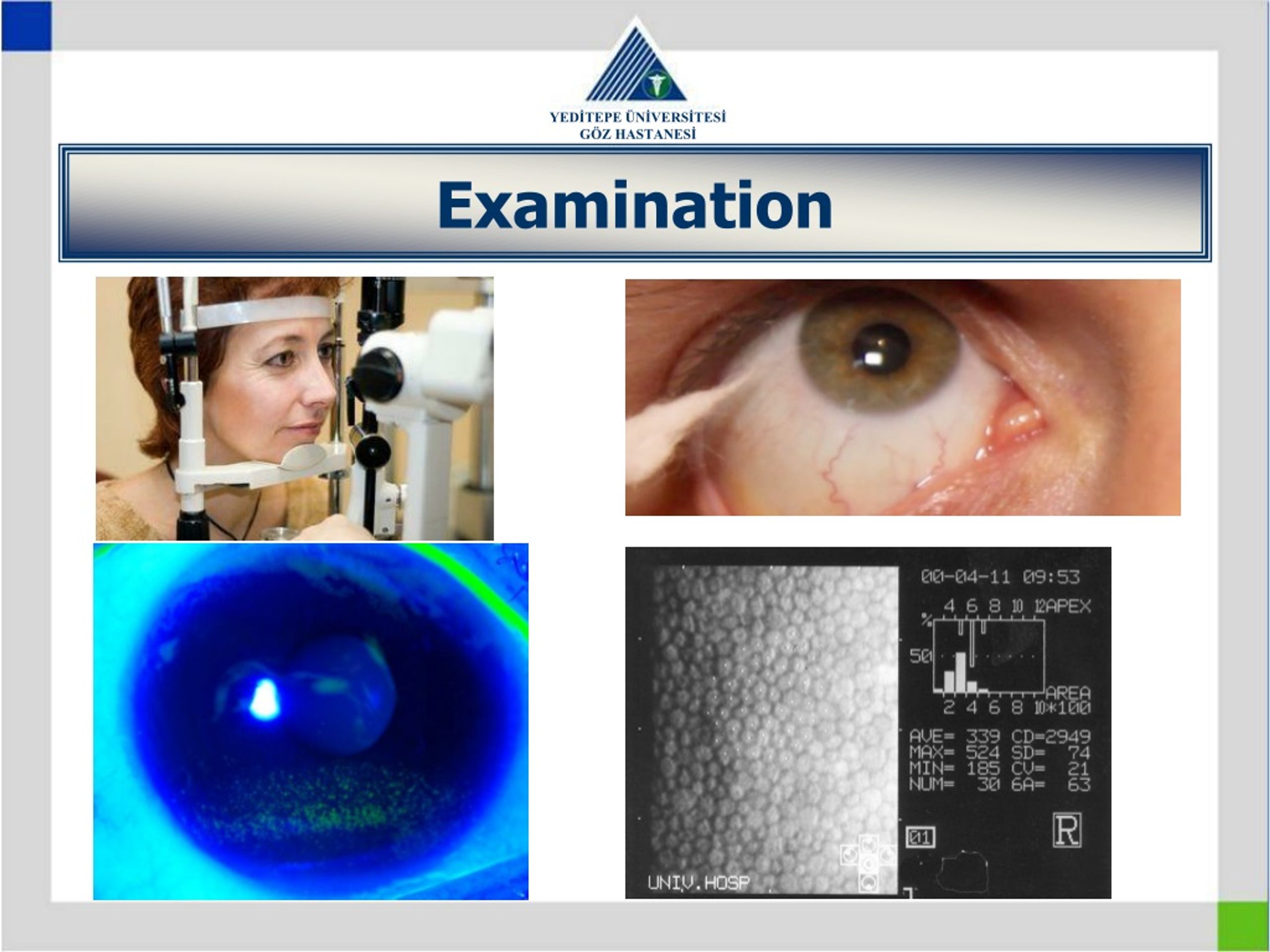 PPT - DISORDERS OF THE CONJUNCTIVA AND CORNEA PowerPoint Presentation ...