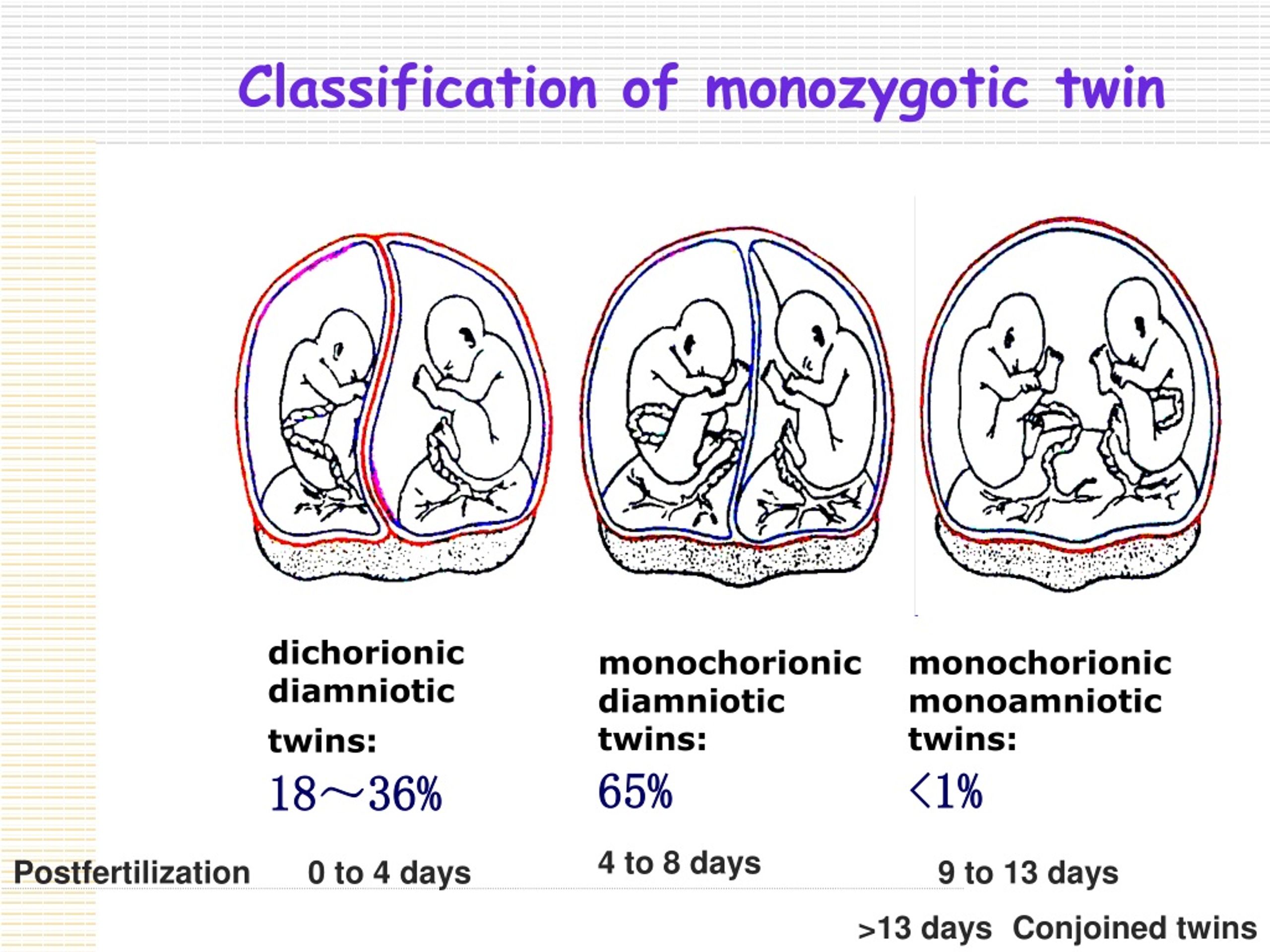 PPT - Multiple Pregnancy PowerPoint Presentation, Free Download - ID ...