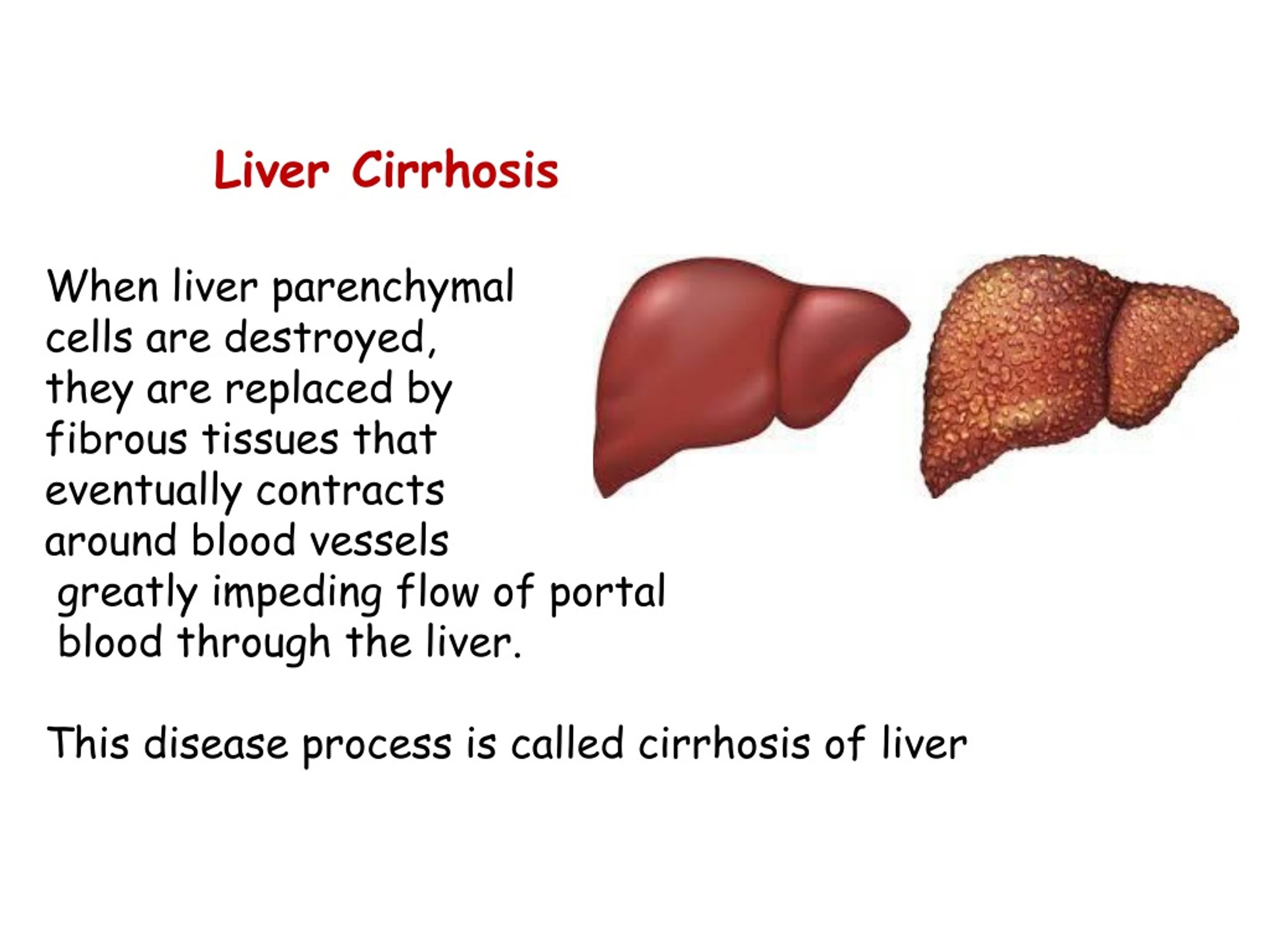 PPT - Liver Physiology PowerPoint Presentation, free download - ID:9204308