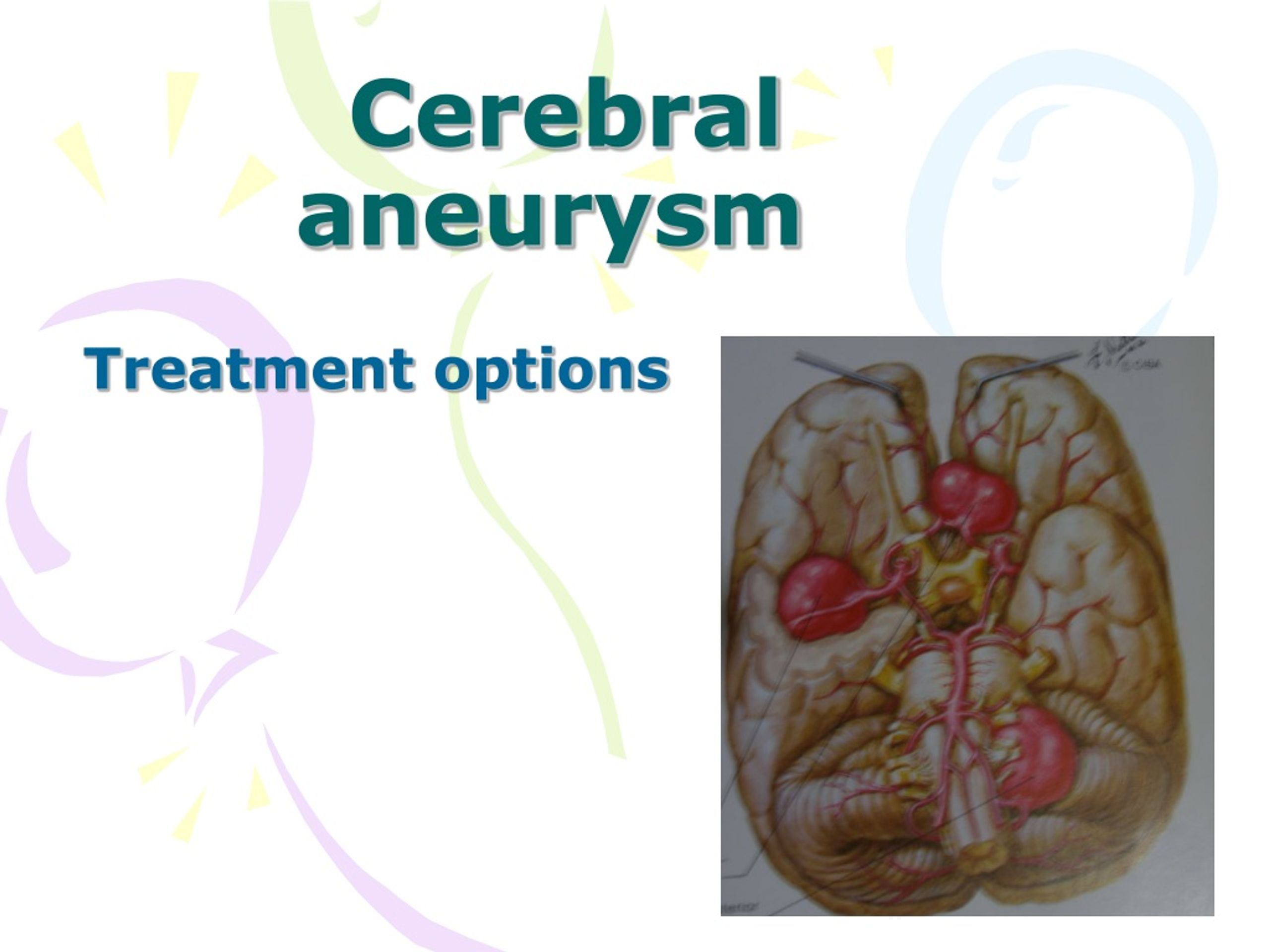 Ppt Subarachnoid Hemorrhage Powerpoint Presentation Free Download