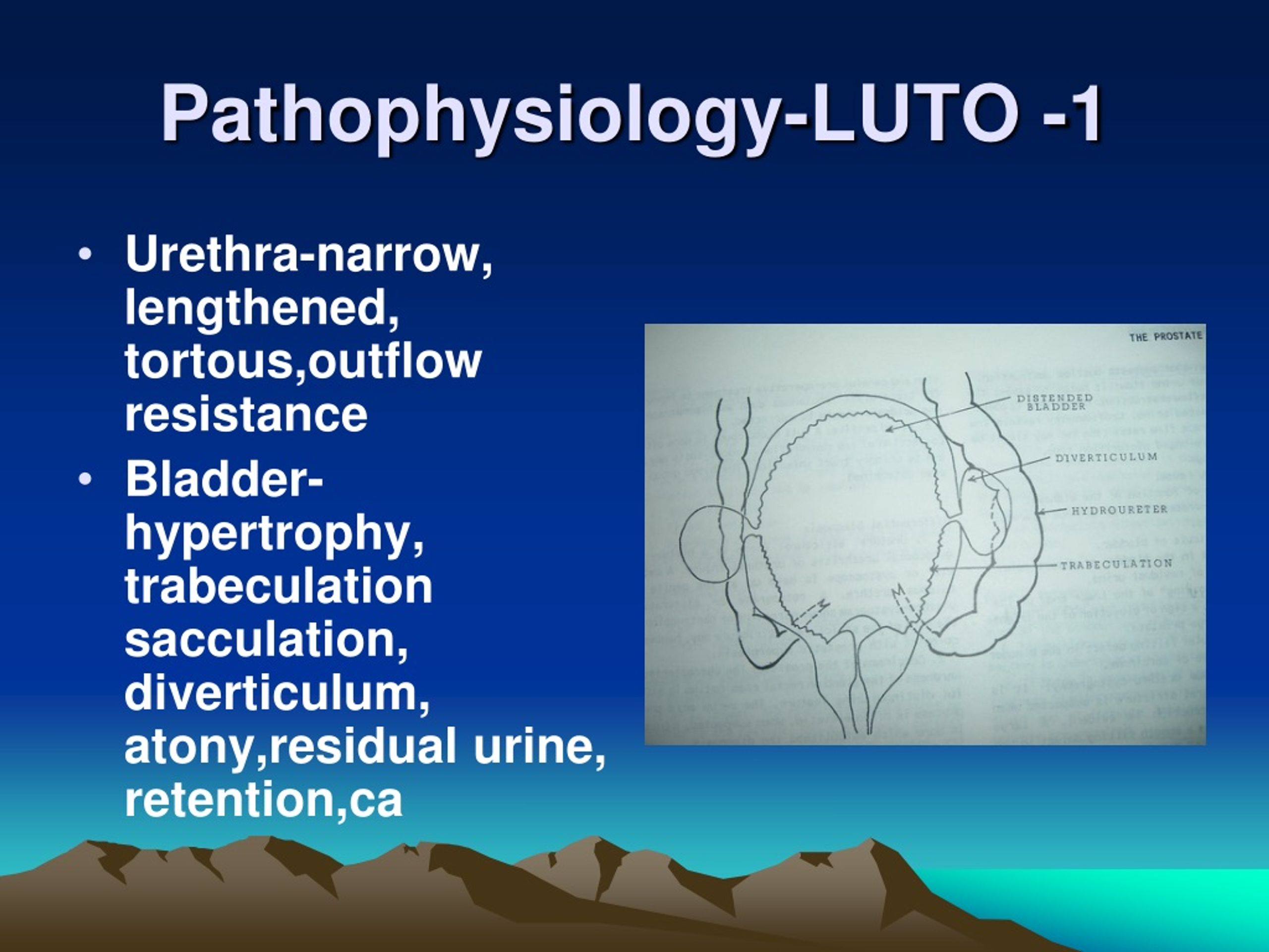 PPT - OBSTRUCTIVE UROPATHY PowerPoint Presentation, Free Download - ID ...