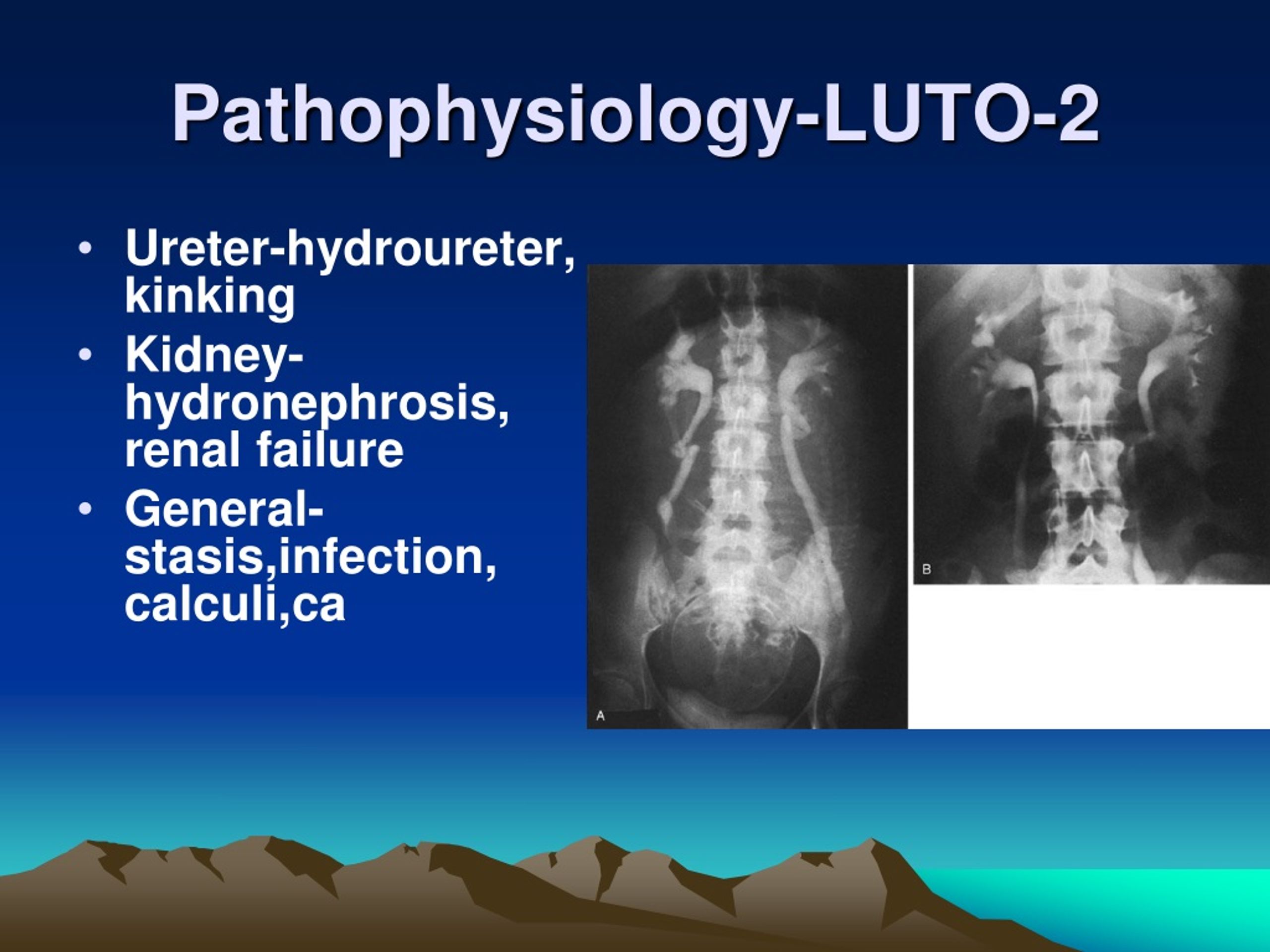 PPT - OBSTRUCTIVE UROPATHY PowerPoint Presentation, Free Download - ID ...