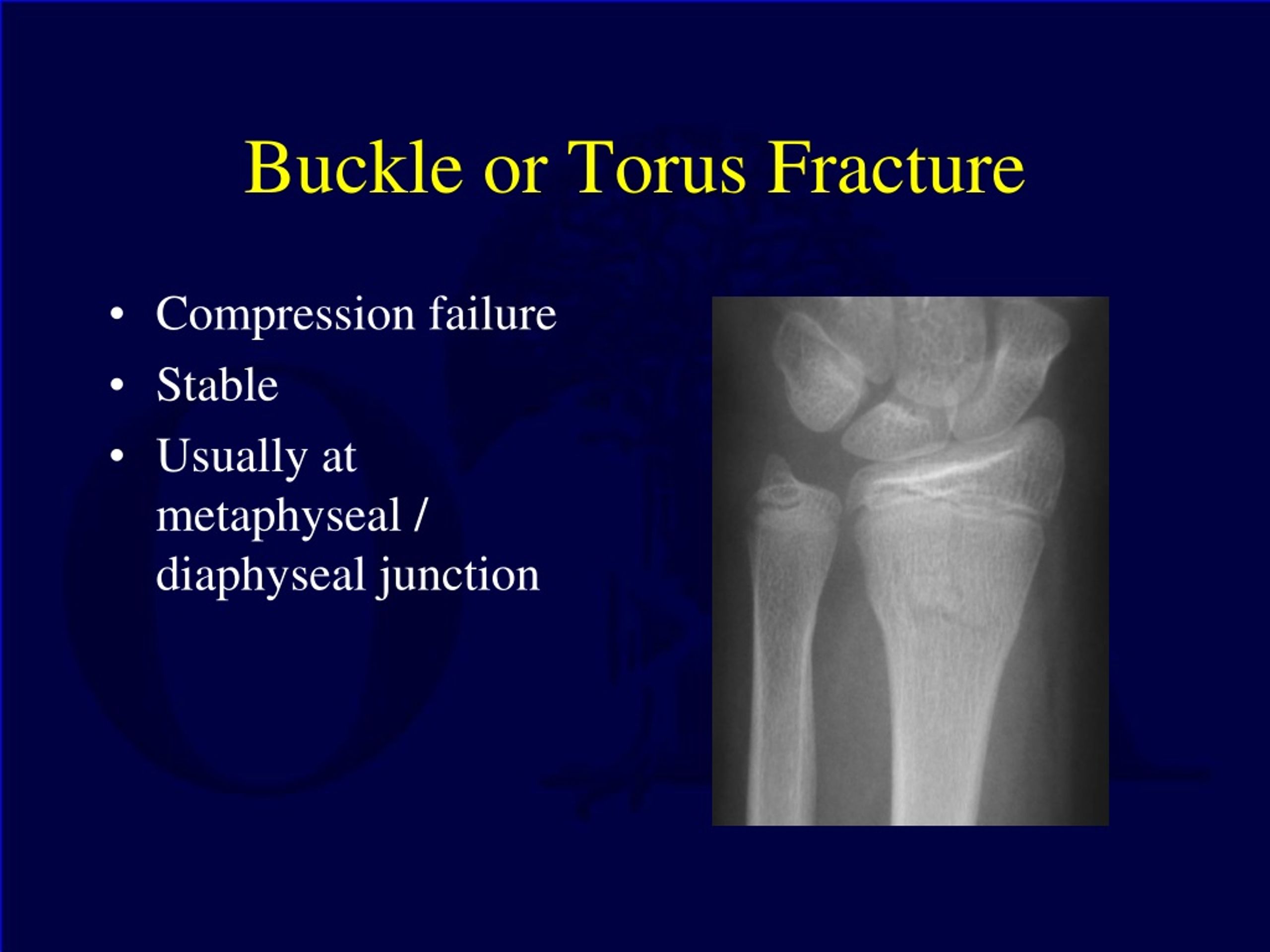 torus fracture healing time