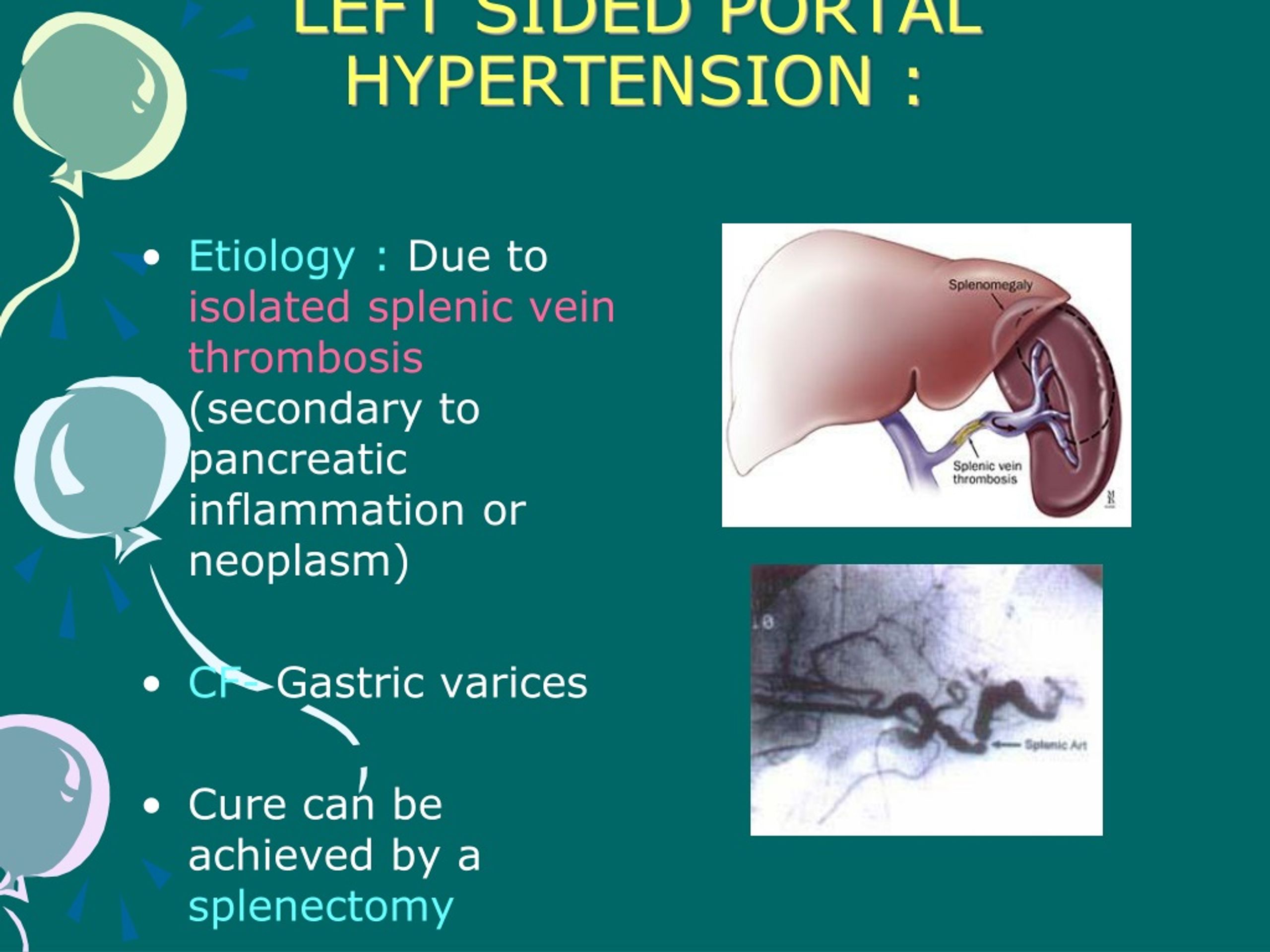 most common presentation of portal hypertension