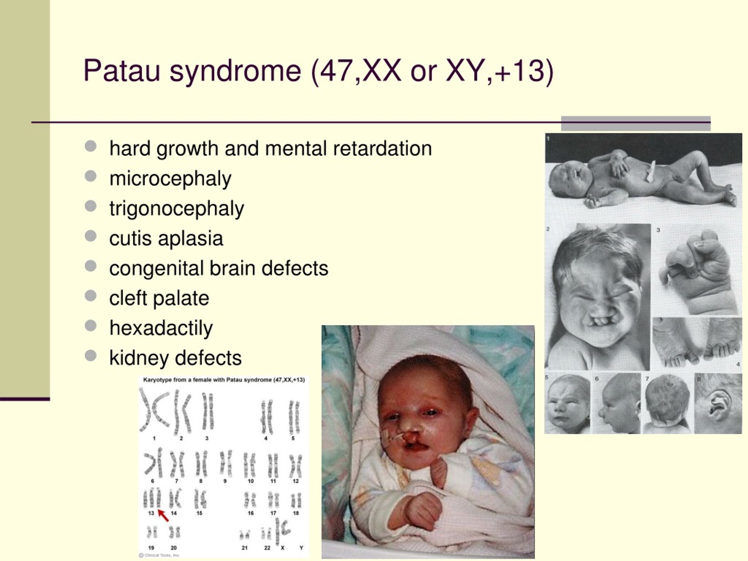 Ppt Cytogenetics And Integrated Laboratory Of Molecular Cytogenetics