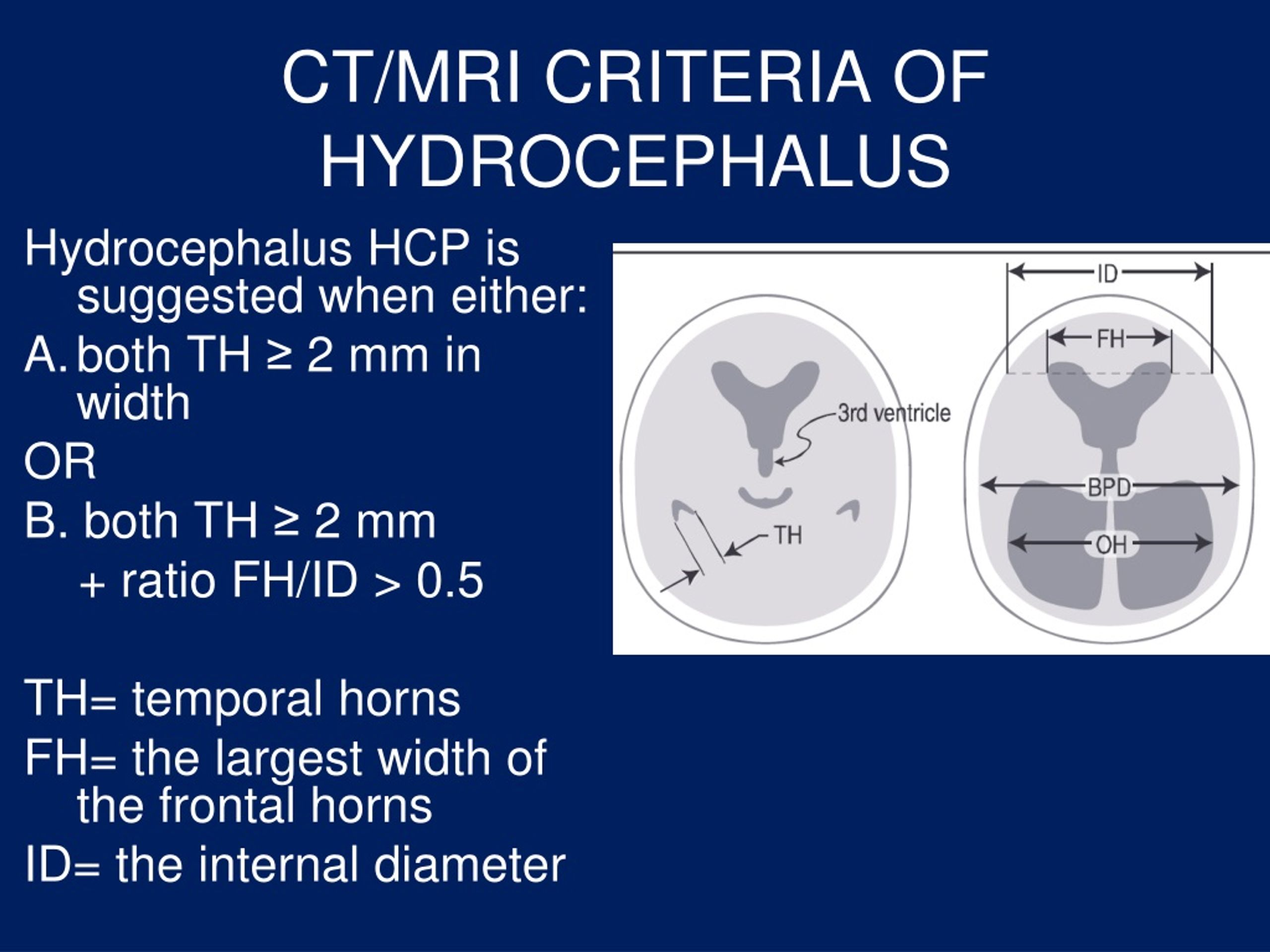 Ppt Hydrocephalus Ventriculo Peritoneal Shunt Powerpoint Presentation Id9224266 7775