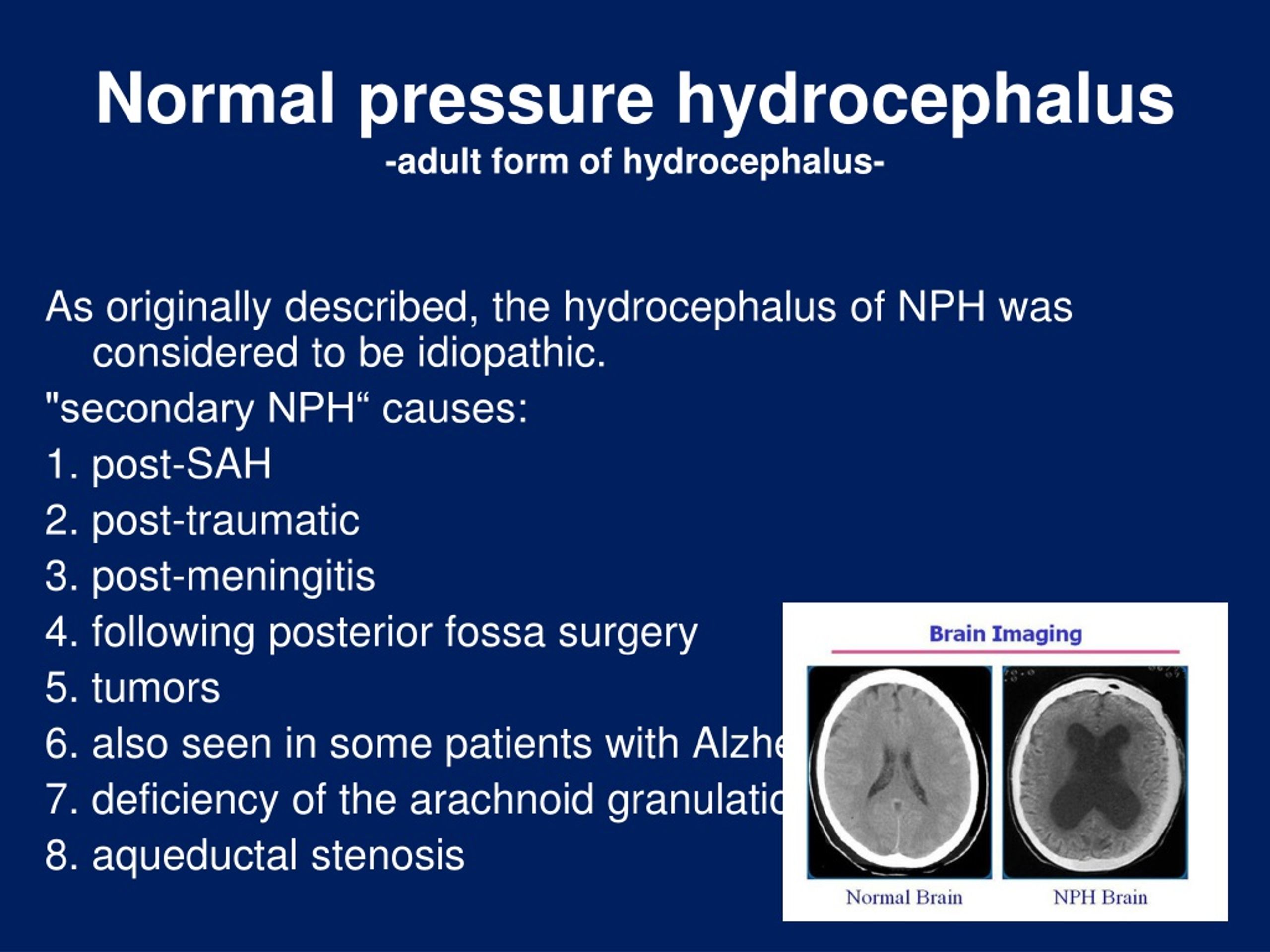 Ppt Hydrocephalus Ventriculo Peritoneal Shunt Powerpoint Presentation Id9224266 0047