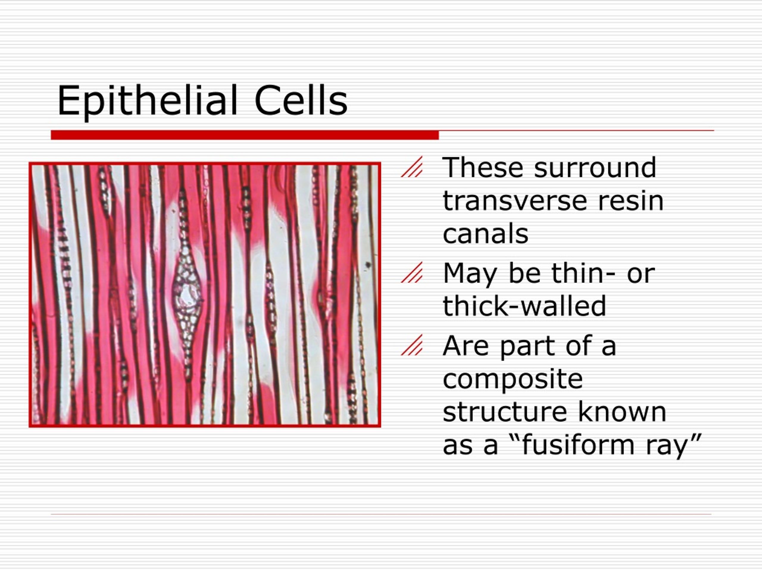 PPT - Lecture #5 - Anatomical Structure of Softwoods, part I PowerPoint ...