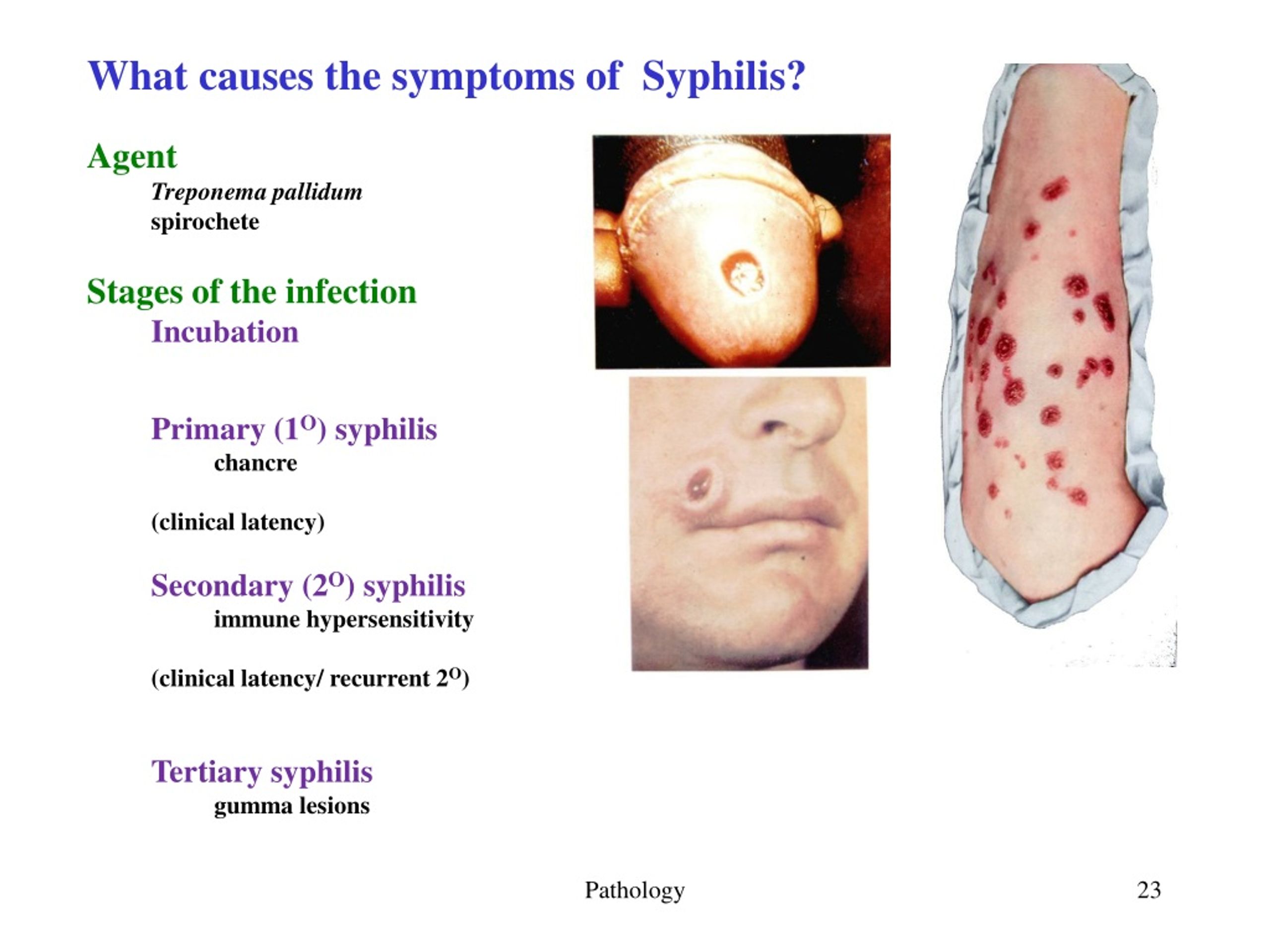 PPT - Epidemiology and Disease Processes Chapter 17, examples from ...