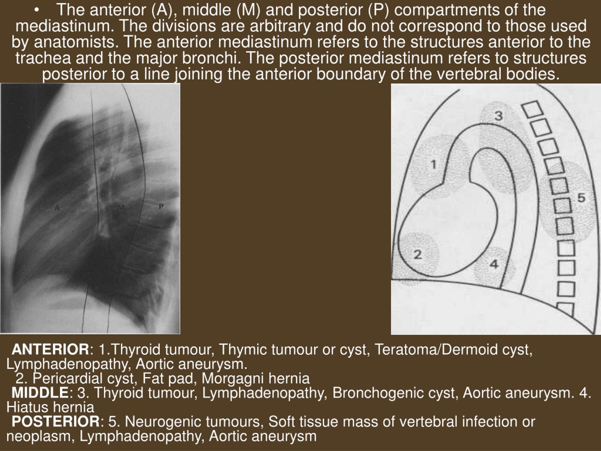 PPT - RADIOLOGICAL EXAMINATION OF THE MEDIASTINUM AND DIAPHRAGM ...