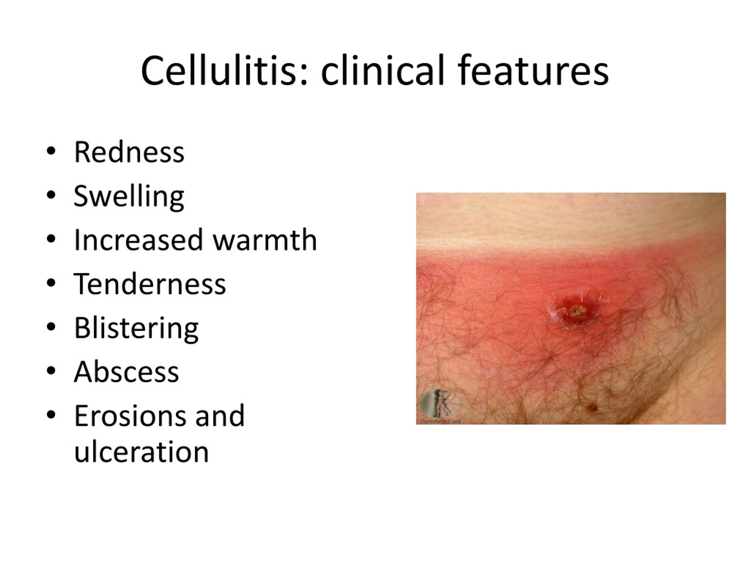 Ppt Skin Infections And Infestations Powerpoint Presentation Free Download Id9250239 